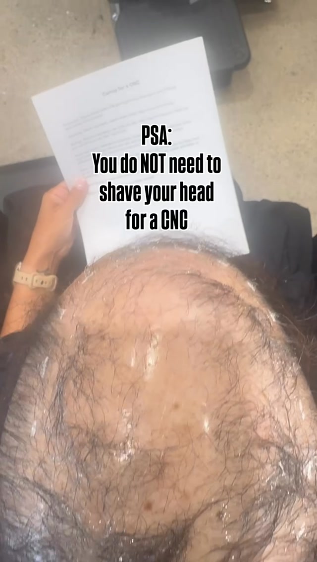 Whoever told you a CNC requires shaving your head… we need to talk ASAP ‼️
This client came to us after another salon over-bonded her system and shaved her head.
For someone already going through hair loss, that experience was incredibly traumatic.
We gave her a wig and let her hair grow for four weeks.
Then we were able to give her this.
A small CNC.
A cute short style.
And her natural hair growing underneath.
CNC by @crlab_official is often used during hair regrowth, including after chemotherapy and other forms of medically related hair loss.
You do not have to sacrifice your remaining hair to wear one.
#hairloss #hairlosssolutions #hairlosstips #hairlosscommunity #hairlosshelp