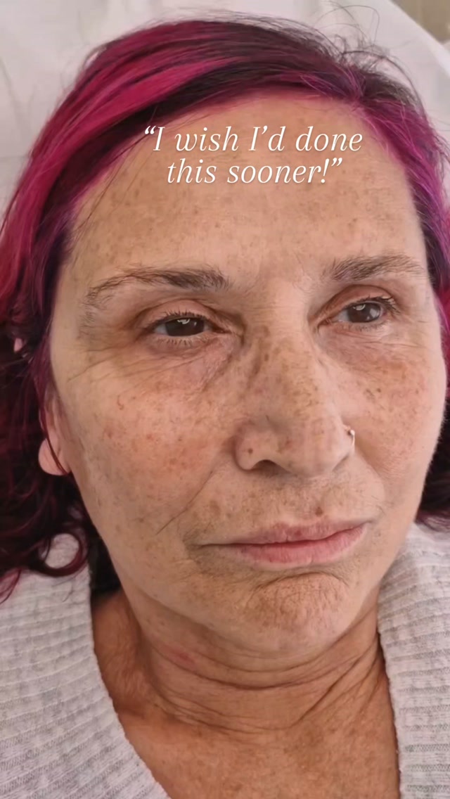 Free consultations where I show you with predraw what could be achieved..no pressure, no commitment. Link in my bio
#ehpermanentmakeup #stalbansalon #permanentmakeupstalbans #stalbanspowderbrows #browsstalbans