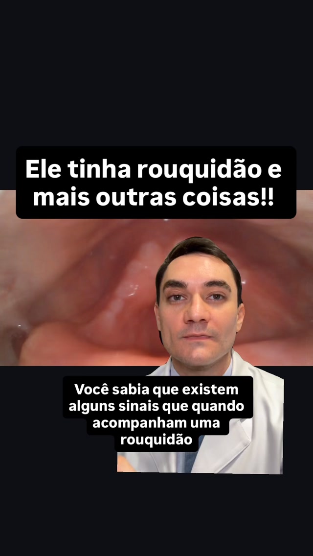 Rouquidão por mais de duas semanas acompanhada de dor para engolir, engasgos, falta de ar, emagrecimento, tosse persistente… São sinais e sintomas que precisam de avaliação mais rápida! Esse paciente fez o certo: procurou ajuda para realização de uma videolaringoscopia.