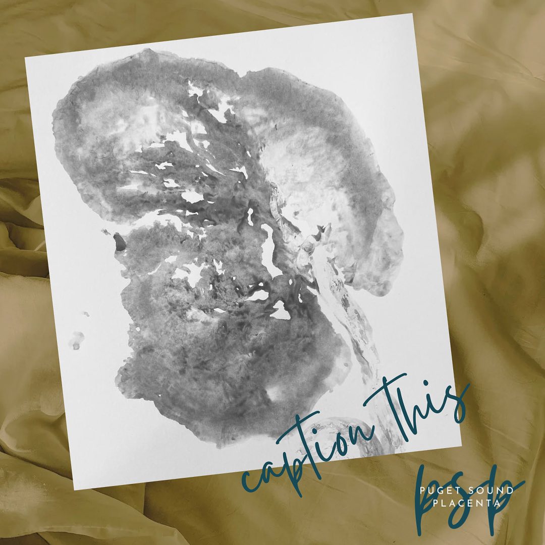 Weāve always thought placentas are pretty magical! And sometimes these prints are just āWHOA!ā
What do YOU see when you look at this?
#placentaart #placentaencapsulation #placentalove #placentaencapsulation #postpartumlife #pugetsoundplacenta #seattleplacenta #welcometothe4thtrimester