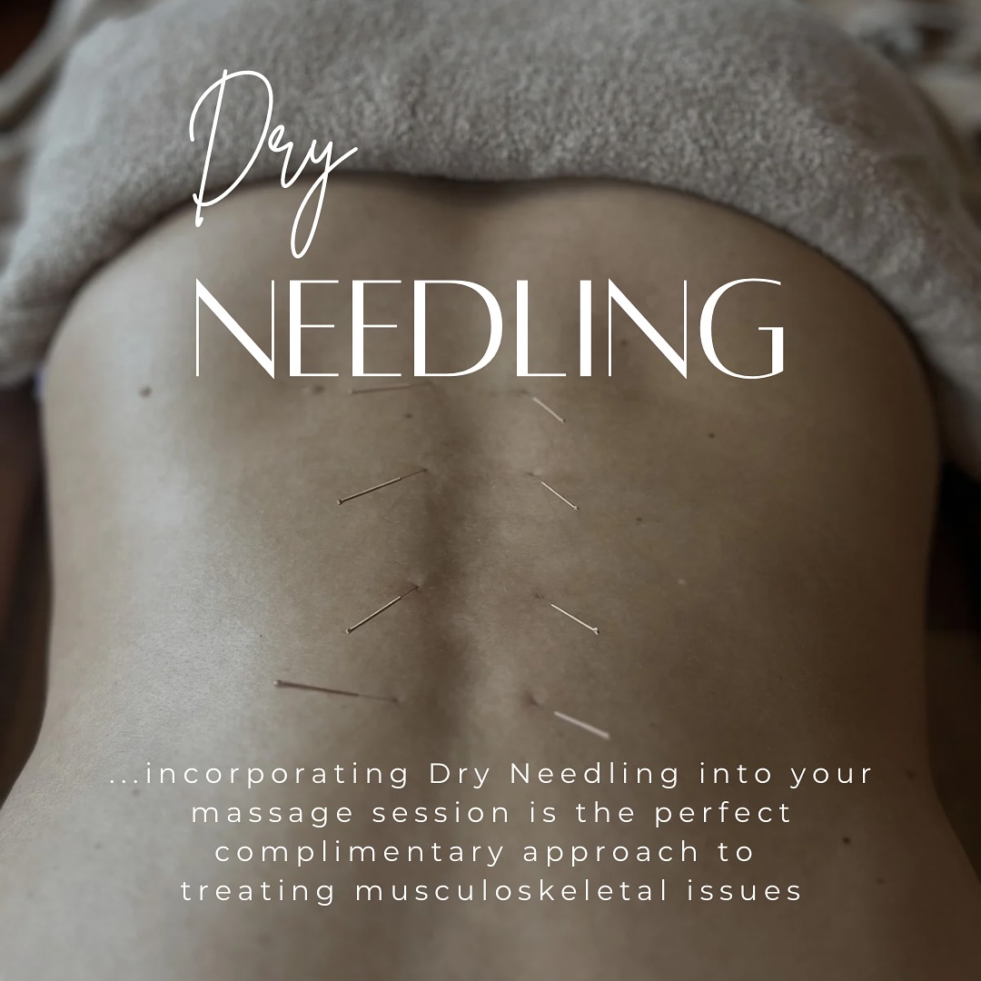 DRY NEEDLING… Incorporate it into your next massage session!
Super thin needles are inserted into an effected muscle causing a contraction or ‘Twitch Response’.
This signals the brain to
• Increase Blood Supply
• Release Tension
• Relieve Pain
• Improve Mobility + Function
Find out more
https://www.reviveandrestore.com.au/restore-copy
#reviveandrestoremassage #dryneedling #massage #remedialmassage #massagemelbourne #needling #twitchresponse