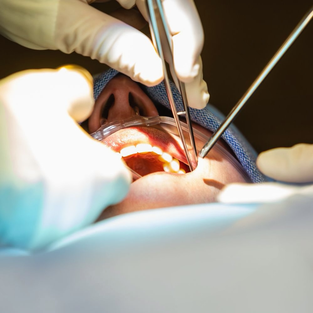From consultation to recovery, trust us with your smile’s journey! 😁🦷
#POMS