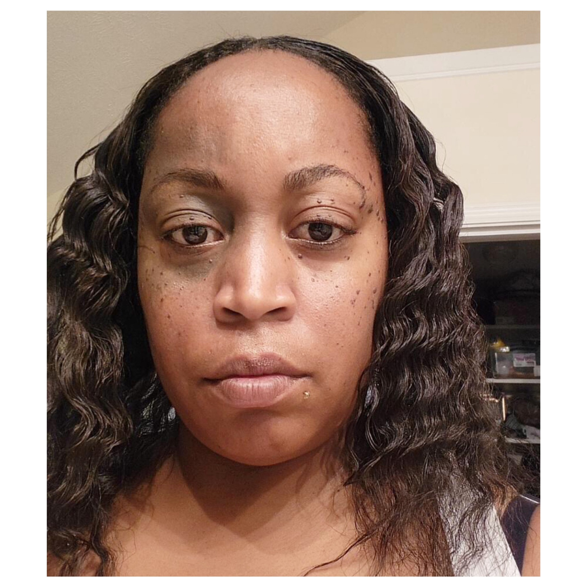 This beauty has a pigmented birthmark around her eye and it also goes into her hair. The shade of it even changes with the seasons. Our bodies are amazing!🥰❄️🌱☀️🍂
.
.
.
.
.
.
.
.
.
#spotlight #birthmark #nevus #pigmentedbirthmark #seasons #birthmarkawareness #skindifferent #visibledifference #birthmarksarebeautiful #facialbirthmark #facialdifference #beautifullyblemished #BBfamily