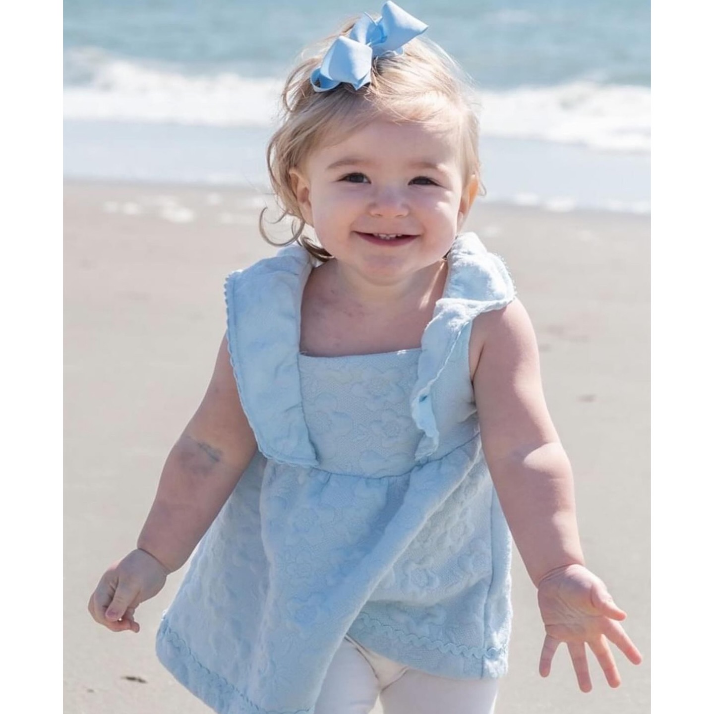 This little beauty has the #spotlight today. Paisleigh aka “Blue-nique” (love that nickname) and Mommy are educating us today on what makes this precious girl so unique.🥰—
. . .
“This Our sweet girl was diagnosed at 3 months old with an AVM (arteriovenous malformation) in her arm/hand. An AVM is a type of birthmark within the vascular system, hers specifically being a tangle of blood vessels. We had quite a traumatic experience while finding out what was causing the blue/purple color. I will forever do anything I can to raise awareness to this condition and advocate for my baby! Different doctors have said at different times that Paisleigh’s presentation and case is very different that it’s unusual and unique. It’s fitting in that we call her “Blue-nique”🩵 I’ll never understand why she has this or why we went through what we did to find out about what she had, but God was with us and I know He has a purpose.”
⠀⠀⠀⠀⠀⠀⠀⠀⠀
** thank you for sharing, Haleigh.💞
.
.
.
.
.
.
.
.
.
.
.
.
#avm #birthmark #awareness #birthmarkbeauty #visibledifference #advocate #unique #BeautifulAsIam #skindifferent #rare #rareisbeautiful #BBfamily