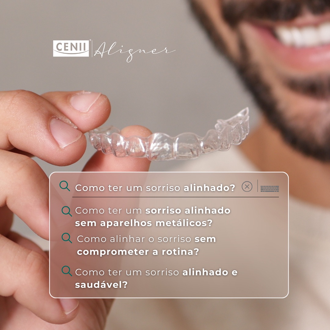 Ter um sorriso alinhado e saudável é mais acessível do que você imagina!
Com o CENII Aligner, é possível alinhar os dentes de forma discreta e confortável, sem a necessidade de aparelhos metálicos.
Como ter um sorriso alinhado sem aparelhos metálicos? A resposta está nos alinhadores estéticos do CENII Aligner. Eles são praticamente invisíveis, removíveis e personalizados para seu sorriso, oferecendo uma alternativa eficiente aos tradicionais aparelhos metálicos.
Como alinhar o sorriso sem comprometer a rotina? O CENII Aligner é ideal para quem deseja discrição e praticidade. Ele pode ser removido durante as refeições e para escovar os dentes, tornando o tratamento confortável e sem impactar sua rotina diária.
Como ter um sorriso alinhado e saudável? Além de corrigir o alinhamento dos dentes, o CENII Aligner também facilita a higiene bucal, já que é removível, garantindo que seu sorriso fique não apenas bonito, mas também saudável ao longo do tratamento.
Com o CENII Aligner, transformar seu sorriso é simples, discreto e eficiente.