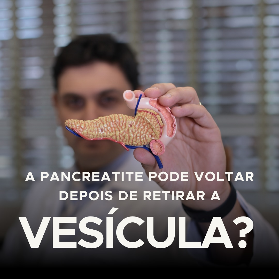 Mesmo após a retirada da vesícula biliar, a pancreatite ainda pode ocorrer. Fique atento a sinais como dor abdominal e náuseas. Ao notar qualquer sintoma, consulte seu médico para garantir um acompanhamento adequado. Cuide bem da sua saúde! #Pancreatite #SaúdeDigestiva #CuidadosComASaúde