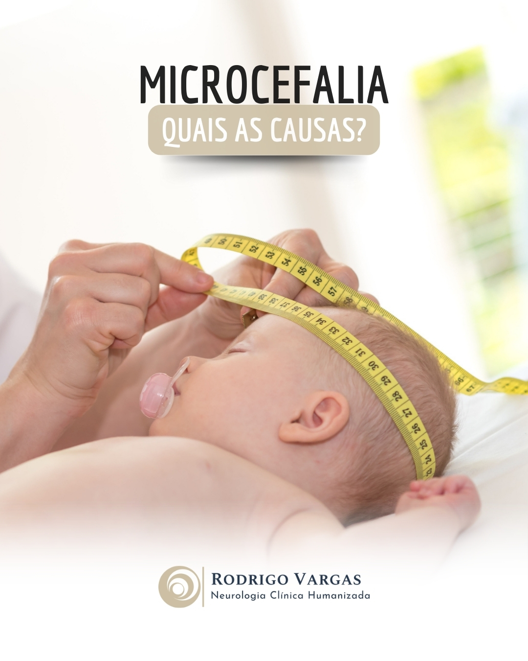 A microcefalia é uma condição em que o tamanho da cabeça é significativamente menor que o esperado para a idade e sexo da criança, resultante de alterações no desenvolvimento cerebral. Suas causas podem ser genéticas, ambientais ou uma combinação de ambas.
Causas Genéticas:
Mutação em genes relacionados ao desenvolvimento do cérebro pode levar à microcefalia primária, geralmente presente ao nascimento. Síndromes genéticas, como a Síndrome de Seckel ou a Síndrome de Cornelia de Lange, também estão associadas à microcefalia.
Fatores Ambientais:
Infecções Congênitas: Infecções durante a gravidez, como Zika vírus, rubéola, citomegalovírus e toxoplasmose, podem causar microcefalia ao interferir no desenvolvimento fetal.
Exposição a Substâncias Tóxicas: Consumo de álcool, uso de drogas, exposição a radiação ou substâncias químicas tóxicas pela gestante.
Desnutrição Materna: A falta de nutrientes essenciais, como ácido fólico, afeta o crescimento cerebral fetal.
Complicações Gestacionais: Insuficiência placentária, hipóxia intrauterina (falta de oxigênio) ou restrição de crescimento intrauterino.
Outras Causas:
Traumas durante a gestação, como acidentes ou doenças que comprometem o fluxo sanguíneo para o feto, também podem levar à microcefalia.
A identificação precoce das causas é crucial para planejar o manejo clínico, intervenções precoces e suporte às famílias.
Dr. Rodrigo R. N. Vargas
Médico Neurologista e Neuropediatra
Título de Especialista em Neurologia pela Academia Brasileira de Neurologia (ABN/AMB)
Título de Especilista em Neuropediatria pela Sociedade Brasileira de Pediatria e Academia Brasileira de Neurologia (SBP/ABN/AMB)
Membro Titular da Academia Brasileira de Neurologia (ABN)
Membro Titular da Sociedade Brasileira de Neurologia Infantil (SBNI)
CRM-GO 15286 / RQE 9716 / RQE 18012
#Microcefalia
#PaisAtentos
#Neuropediatria
#OesteGoiano
#rodrigovargasneuro
#HospitalSãoPaulo