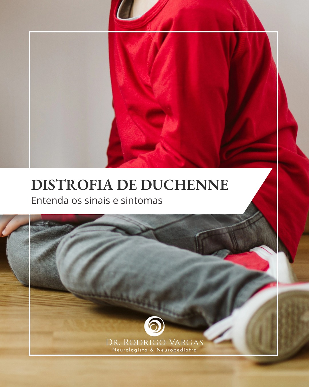 A Distrofia Muscular de Duchenne (DMD) é uma doença genética progressiva que afeta os músculos, causada por mutações no gene que codifica a distrofina, uma proteína essencial para a função muscular. É a forma mais comum de distrofia muscular em crianças e afeta predominantemente meninos, devido à herança ligada ao cromossomo X.
Os primeiros sinais geralmente aparecem entre 2 e 5 anos de idade, incluindo fraqueza muscular, dificuldades para correr, subir escadas ou levantar-se do chão, quedas frequentes e a marcha de "pato". Com a progressão da doença, os músculos dos membros superiores e inferiores se tornam mais fracos, e complicações respiratórias e cardíacas podem surgir devido ao envolvimento dos músculos do tórax e coração.
O diagnóstico é feito por meio de exames como a dosagem de creatina quinase (CK), análise genética e biópsia muscular, quando necessário.
Embora não haja cura, o tratamento multidisciplinar pode melhorar a qualidade de vida. Corticosteroides, como a prednisona, ajudam a retardar a progressão da fraqueza muscular. Fisioterapia, órteses e suporte respiratório são fundamentais. Avanços recentes, como terapias gênicas e tratamentos que visam restaurar a produção de distrofina, oferecem esperança para o futuro.
O acompanhamento especializado é crucial para otimizar o bem-estar do paciente.
Dr. Rodrigo R. N. Vargas
Médico Neurologista e Neuropediatra
Título de Especialista em Neurologia pela Academia Brasileira de Neurologia (ABN/AMB)
Título de Especilista em Neuropediatria pela Sociedade Brasileira de Pediatria e Academia Brasileira de Neurologia (SBP/ABN/AMB)
Membro Titular da Academia Brasileira de Neurologia (ABN)
Membro Titular da Sociedade Brasileira de Neurologia Infantil (SBNI)
CRM-GO 15286 / RQE 9716 / RQE 18012
#DistrofiaMuscularDeDuchenne
#FraquezaMuscular
#DMD
#PaisAtentos
#Neuropediatria
#OesteGoiano
#rodrigovargasneuro
#HospitalSãoPaulo