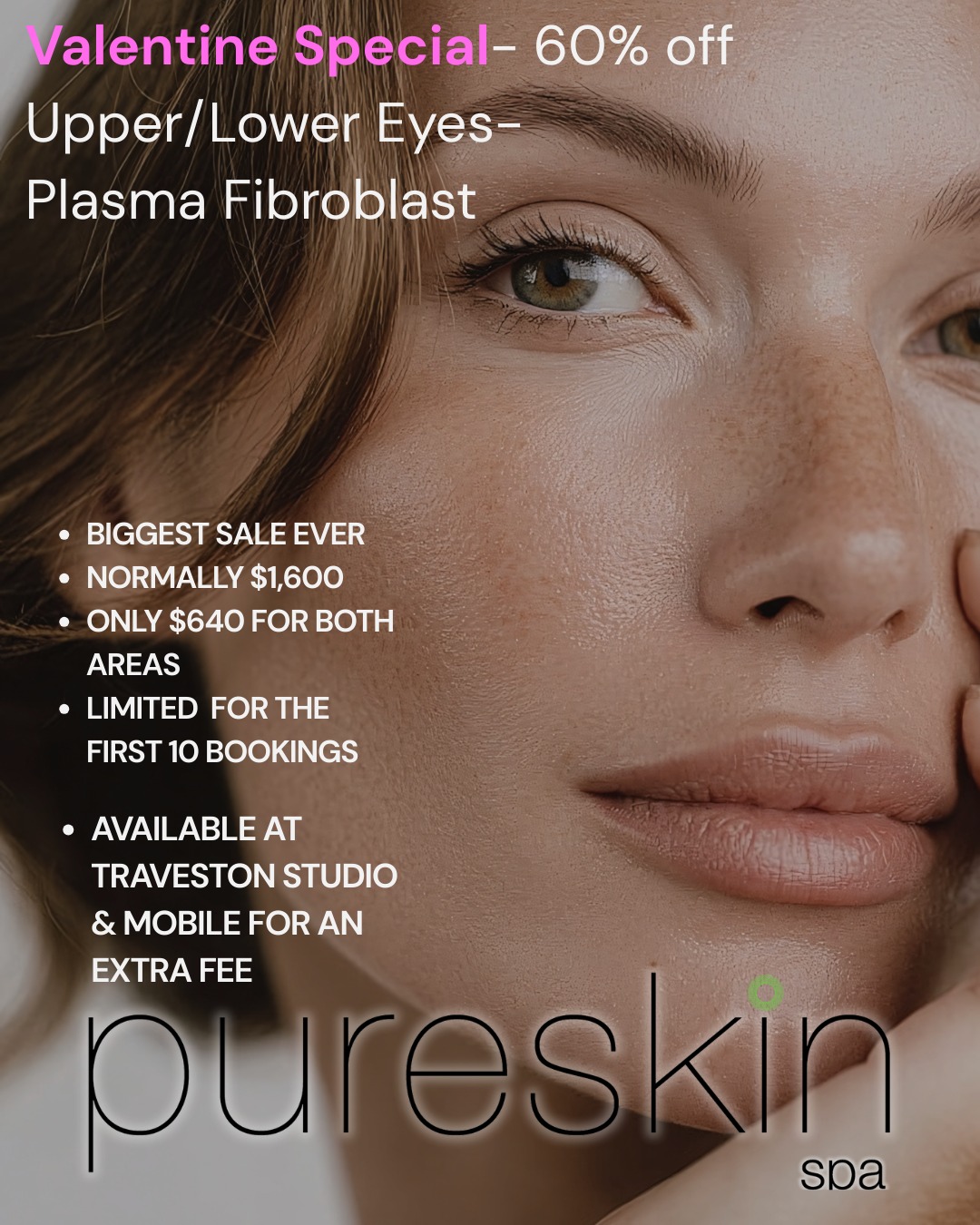 💥Valentines Day-60% Off-$640 FOR BOTH AREAS, NORMALLY $1800
❤Perfect to tighten hooded eyelids
❤Tighten the delicate eye area
❤Younger longer
Limited- Only for the first 10 bookings
Studio is based in Traveston, mobile is available for an extra fee
Love your skin, YOUNGER LONGER, without surgery
Long lasting results
Afterpay, Zippay, Eftpos available
#pomona #southside #kangdanga #gympieregion #Imbil #dagun #Traveston #gympie #lovemyskin #joneshill #Gympie #maryvalley #cooran #sunshinecoasthinterland #openingspecials #sunshinecoast #plasmapentreatment #plasmaskintightening #plasmafibroblast #eyelifting #GympieRegion #youthful #SkinTighteningFacial #plasmalift #plasmalifting #skintightening #sunshinecoastmums #plasma #kandanga #afterpay