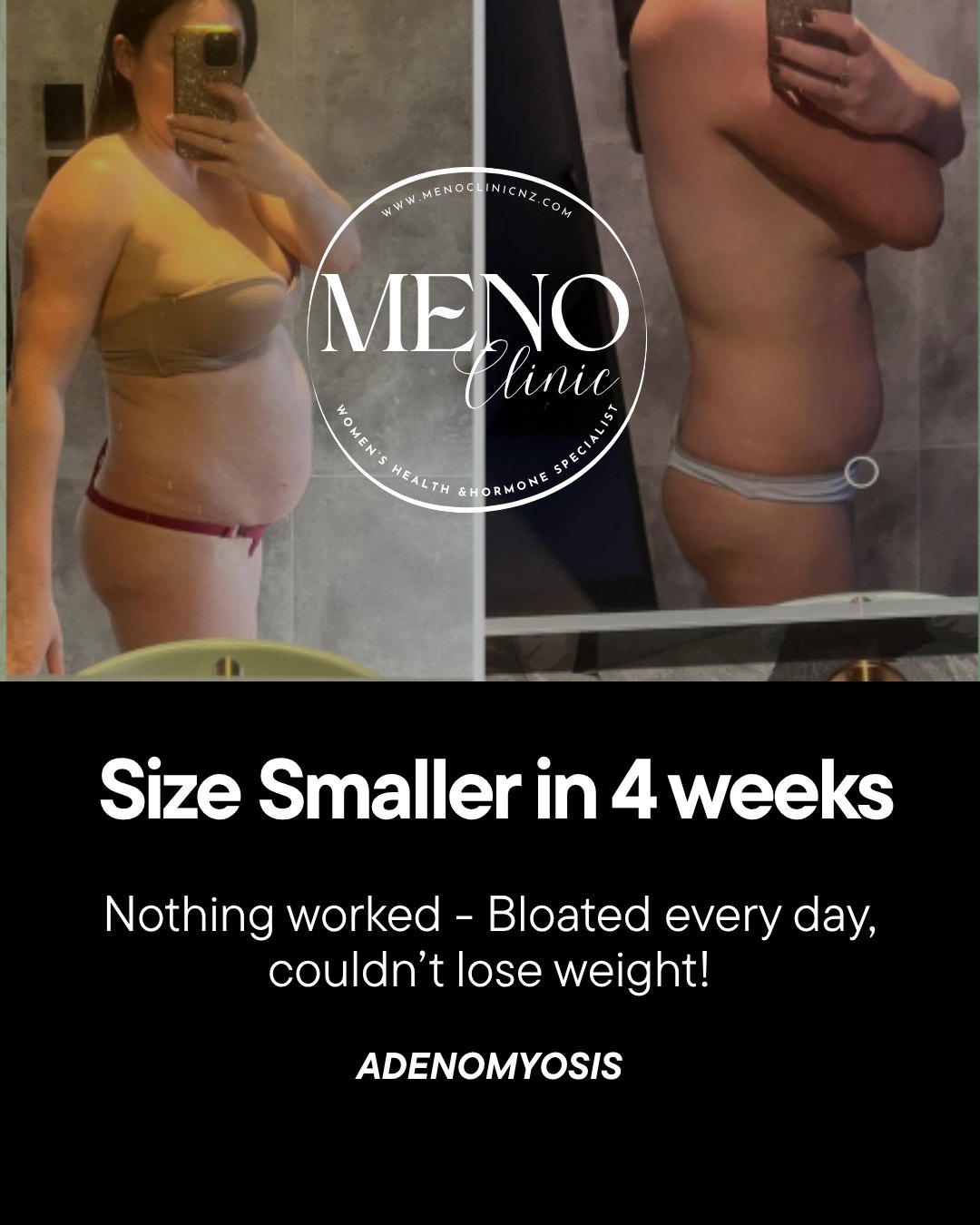 Don't just "put up with it" - feel the difference in weeks!
The dreaded Adenomyosis, Endometriosis, PCOS or horrid PMS diagnosis doesn't come with "this is your forever life" verdict.
Yes, they come with change.
But now we have enough of data and knowledge to know what they are causing in our body and how to help navigate, manage and aleviate symptoms with easy steps.
Hannah is a shining exmple.
Came to me with severe blaoting, anxiety, pain, sore joints, no energy, weight gain and no matter what she tried has worked or was sustainable for long.
We looked at Hannah's daily habits.
Changed them slightly by shifting some meals, making them more filling and better for blood sugar and cortisol response.
We worked with her life - she has a 5yo daughter and business.
NO comolicated routrines but rtaher helped her to find hacks and tips to save time, to make things simple and work for her.
This photo is in 4 weeks.
Her anxiety is nearly gone.
Joint pain that was stopping her work is nonexistyent.
She is losing weight, massively.
No bloating
And has more energy to live her full life.
If you had a Adeno or Endo dieagnosis and are suffering with symptoms noone can help, reaxch out.
WOmen's health is our specialty in meno Clinic.
NO complicated routines, but rather helped her to find hacks and tips to save time, to make things simple and work for her.