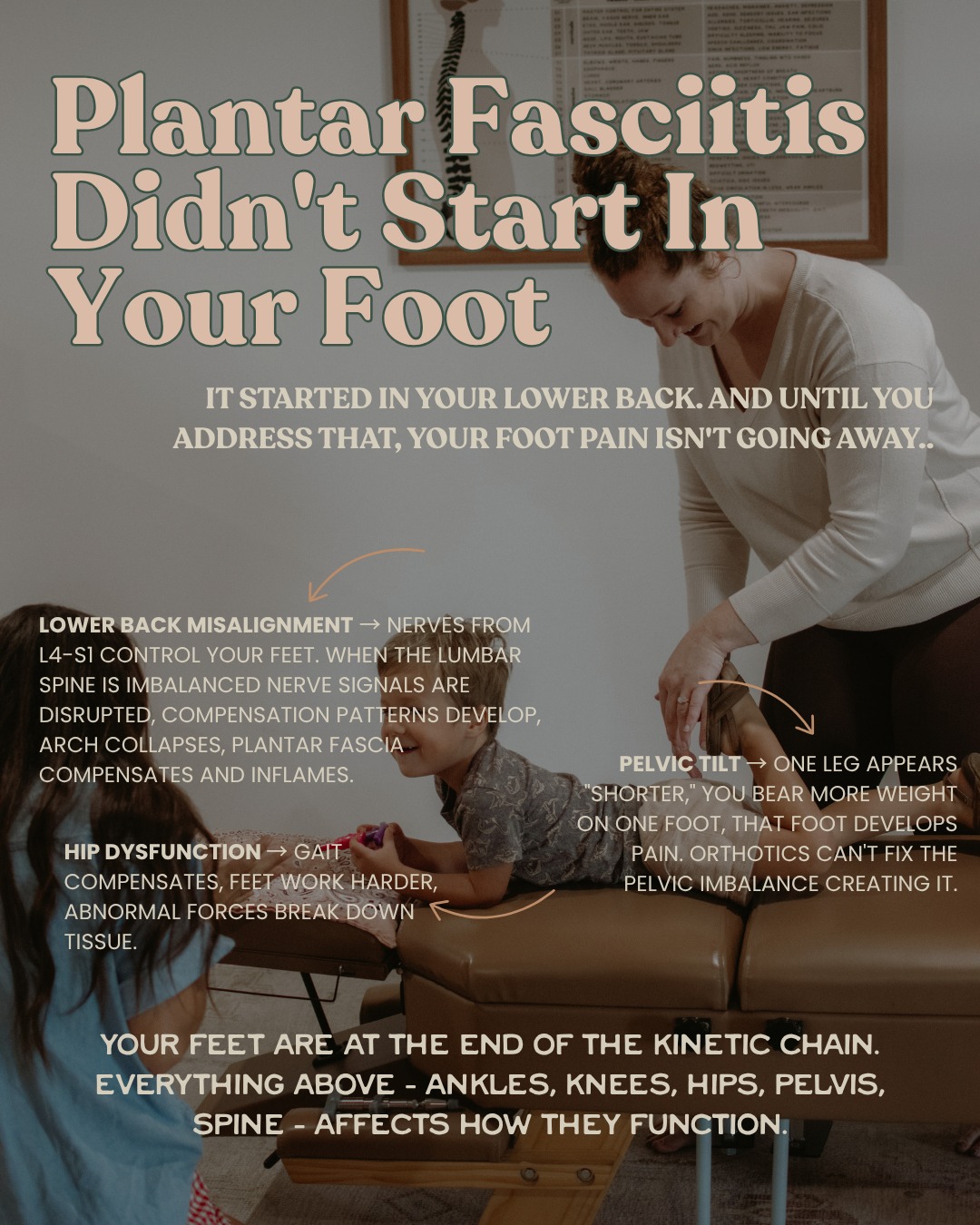You might be thinking that plantar fascitis is just a foot issue, but did you know that your plantar fasciitis didn't start in your foot? It started in your lower back.
You've tried orthotics, better shoes, stretching, foot massages, rest.
Nothing lasts.
Here's why: You're treating the symptom (foot), not the root cause (spinal compensation).
Your feet are at the END of the kinetic chain. Everything above - ankles, knees, hips, pelvis, spine - affects how they function.
The compensation cascade:
Lower back misalignment → Nerves from L4-S1 control your feet. When lumbar spine is misaligned, nerve signals are disrupted, muscle imbalances develop, arch collapses, plantar fascia compensates and inflames.
Pelvic tilt → One leg appears "shorter," you bear more weight on one foot, that foot develops pain. Orthotics can't fix the pelvic imbalance creating it.
Hip dysfunction → Gait compensates, feet work harder, abnormal forces break down tissue.
Knee issues → Altered walking mechanics, feet bear weight abnormally, chronic stress.
Your foot is just the last domino to fall.
Why treating just the foot doesn't work?
Orthotics support the arch but don't fix why it's collapsing (nerve interference).
Better shoes cushion but don't address compensation pattern.
Stretching provides temporary relief but spine keeps pulling it back.
How chiropractic addresses root cause:
✓ Lower back adjustments restore nerve flow to feet
✓ Sacral/pelvic alignment eliminates leg length discrepancy
✓ Hip adjustments restore proper gait
✓ Full kinetic chain assessment identifies where compensation started
When we fix the pattern UP THE CHAIN, foot pain resolves DOWN THE CHAIN.
Stop focusing on stretching and rolling out your foot. It's time to address the body as a whole.
.
.
.
#wildbloomchiro #gallatintn #sumnercounty #plantarfasciitis #health #chiropractic #wellness