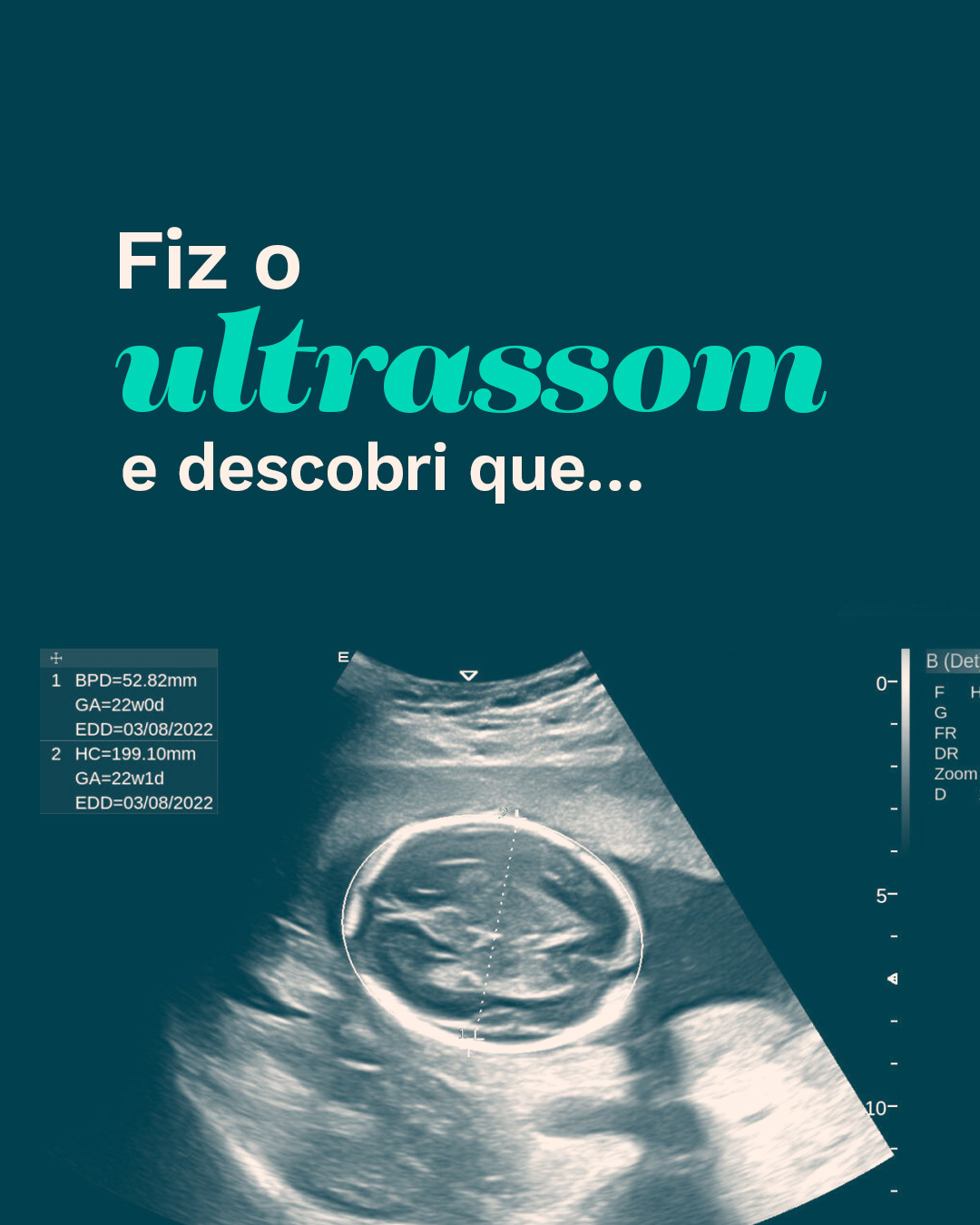 Os sintomas começaram há uns meses.
Primeiro foi leve: suspirar vendo foto de Toscana no feed. Depois veio o enjoo toda vez que alguém falava de viagem e não era pra Itália. Agora está mais avançado: acordo 3h da manhã com vontade de pizza napolitana. Abro Google Flights sem motivo. Choro assistindo vídeo de Veneza. E piora… A mudança de humor repentina quando não consigo planejar. Aí fico irritada, ansiosa, pensando "será que vou conseguir ir esse ano?".
O diagnóstico foi confirmado… e só tem cura indo pra lá.
Se você conhece alguém que vai se identificar com esses sintomas, compartilha esse conteúdo.
#italia #viagemitalia #veneza #toscana #humor #meme