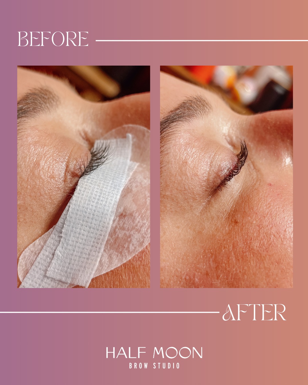A dreamy lash lift before → after by @tstone.beauty.indy 🌙
A lash lift is basically a perm for your natural lashes 🌿 no extensions, no falsies... Just YOUR lashes, lifted and curled to perfection. Results last 6-8 weeks and look gorgeous even without mascara.
Ready to try it? book through the link in bio 💕
#indyselfcare #LashLift #LashAndBrow #lashtint #lashliftandtint #indylashes #lashtinting #smallbusiness #BatesHendricks #halfmoonbrow #beforeandafter