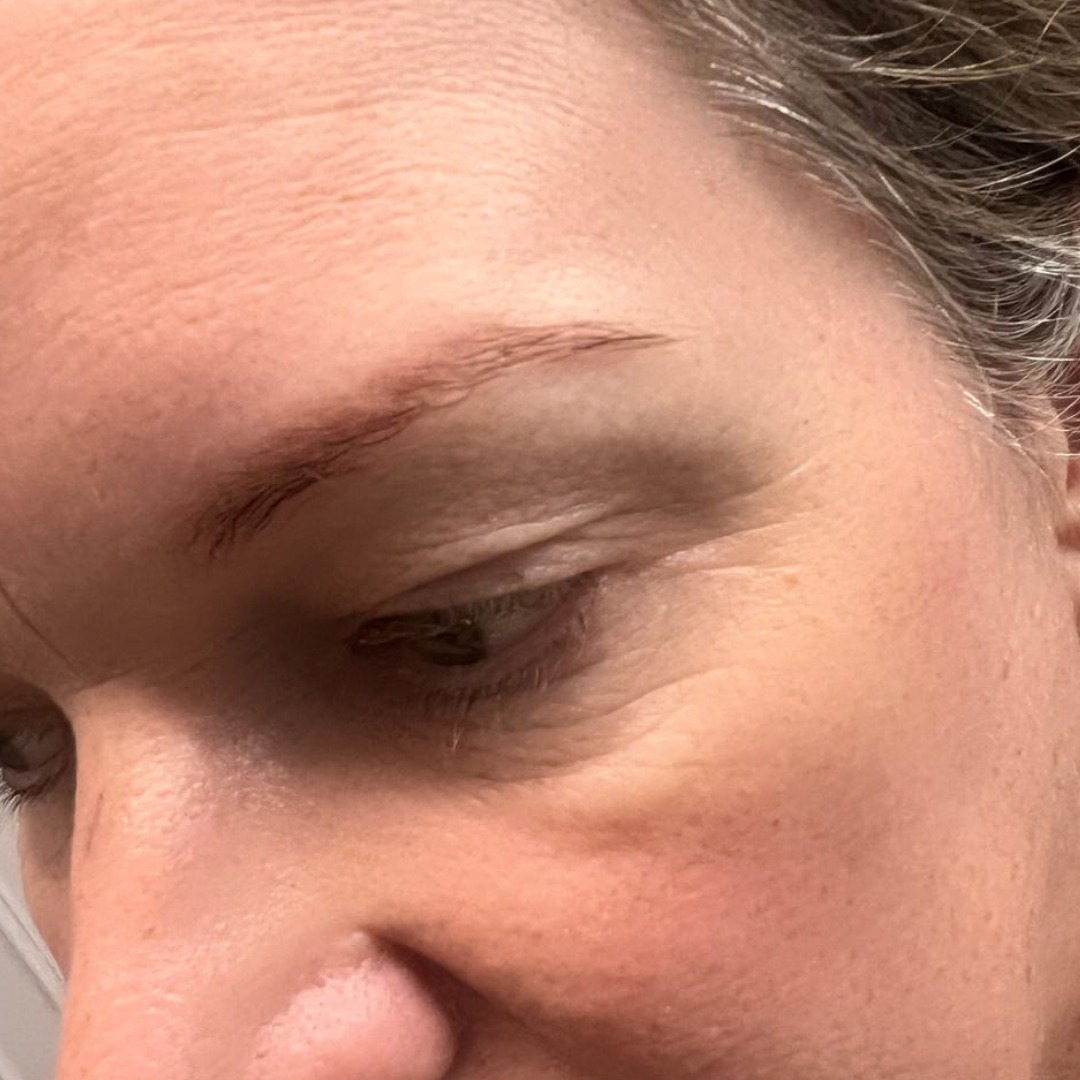 ✨ Brow Refresh Transformation ✨
A soft, clean, and beautifully defined brow transformation 🤎
These refreshed brows now have a smoother shape, better symmetry, and a more natural finish that complements her features perfectly.
Sometimes a small brow adjustment can completely elevate the face ✨
Swipe to see the before and after results ➡️
#EyebrowTattoo #BrowCorrection #BrowTransformation #PowderBrows #OmbreBrows #CosmeticTattoo #PMUBrows #PermanentMakeup #NaturalBrows #BeautyTransformation #BrowsOnPoint #SemiPermanentMakeup #FreshBrows #BrowArtist #BeforeAndAfterBrows