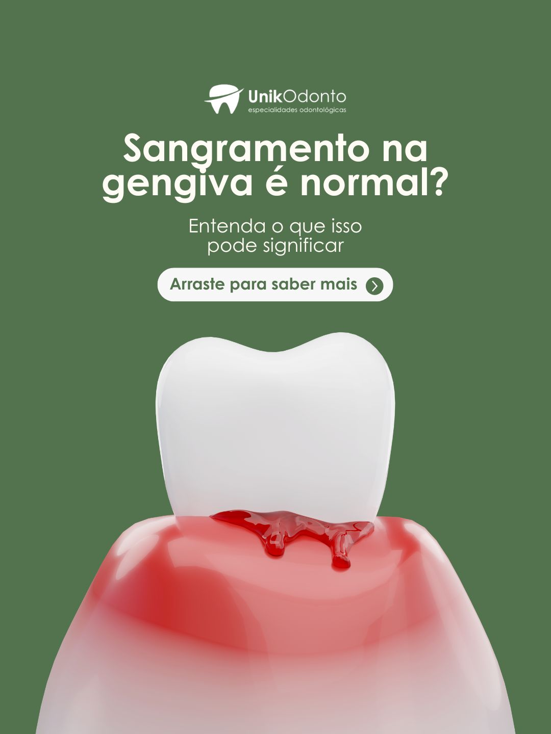 O sangramento durante a higienização é um alerta clínico para a presença de inflamações nos tecidos de sustentação.
A periodontia atua justamente na preservação do osso e da gengiva, evitando que quadros de placa bacteriana evoluam para a perda dentária. Nossa equipe especializada realiza o controle da sua saúde periodontal para garantir longevidade ao seu sorriso.
Agende sua avaliação na Unik Odonto e trate sua gengiva com especialistas. 🦷✅
#UnikOdonto #Periodontia #GengivaSaudavel #Prevencao #ViamaoRS