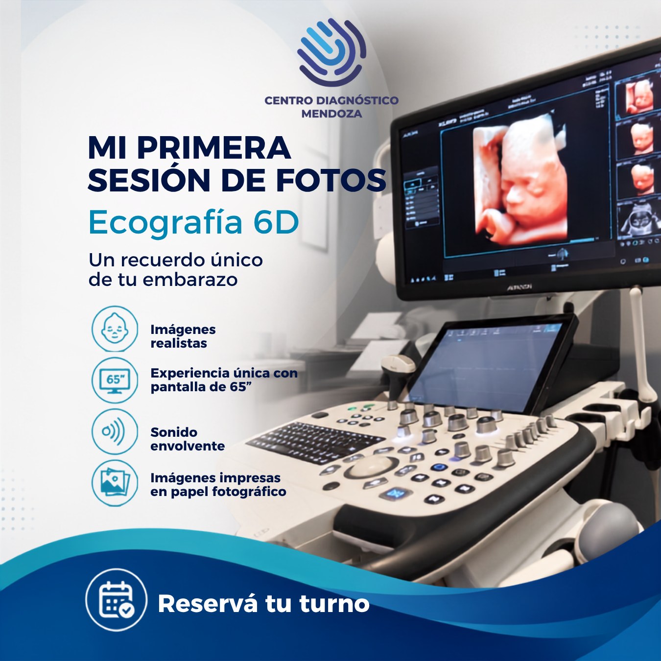MI PRIMERA SESIÓN DE FOTOS
La ecografía 6D te permite vivir una experiencia única durante el embarazo: ver a tu bebé con imágenes realistas, en tiempo real y con gran detalle.
En Centro Diagnóstico Mendoza contamos con tecnología avanzada para que puedas disfrutar este momento de una manera especial, cómoda y segura.
Ecografía 6D
Un recuerdo único de tu embarazo.
✨ Imágenes realistas
✨ Experiencia única con pantalla de 65”
✨ Sonido envolvente
✨ Imágenes impresas en papel fotográfico
✨ Grabación en pendrive (Opcional)
Ideal para compartir este momento con tu familia y guardar un recuerdo inolvidable de esta etapa.
Reservá tu turno.
Centro Diagnóstico Mendoza
📍Av. Belgrano 1484, Ciudad, Mendoza
📲 WhatsApp: +54 9 261 5095907
#Ecografia6D #Embarazo #Eco6D #MedicinaFetal #CentroDiagnosticoMendoza #CDM #Mendoza #EmbarazoMendoza #Maternidad