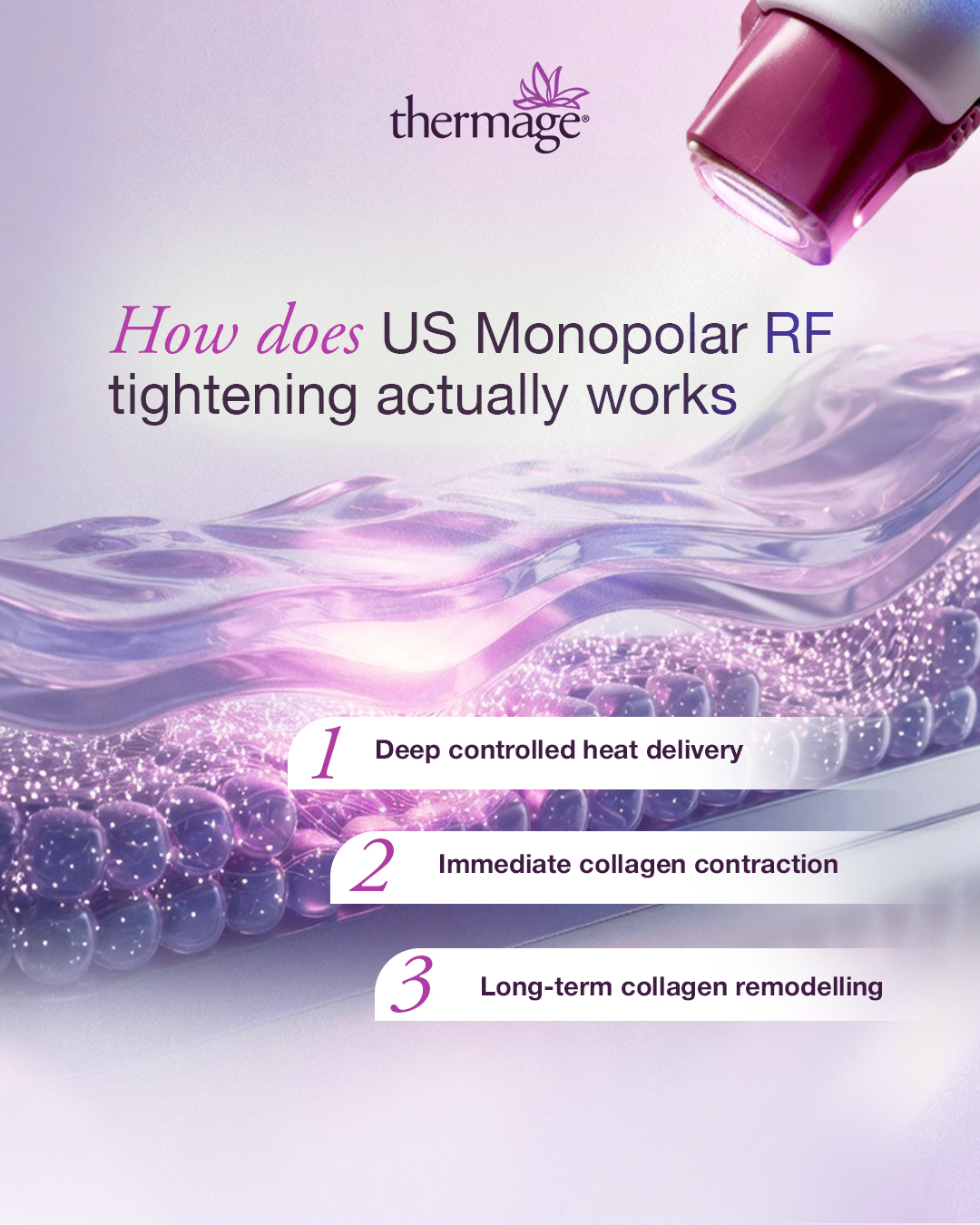 Thermage works by delivering controlled radiofrequency energy deep into the dermis to create a precise thermal response that tightens existing collagen and stimulates long-term remodelling.
Choose Thermage. Timeless. Clinically proven.
THFLX.0034.SG.26
𝘛𝘩𝘦𝘳𝘮𝘢𝘨𝘦®️ 𝘍𝘓𝘟 𝘪𝘴 𝘢 𝘳𝘦𝘨𝘪𝘴𝘵𝘦𝘳𝘦𝘥 𝘮𝘦𝘥𝘪𝘤𝘢𝘭 𝘥𝘦𝘷𝘪𝘤𝘦 𝘪𝘯𝘵𝘦𝘯𝘥𝘦𝘥 𝘧𝘰𝘳 𝘶𝘴𝘦 𝘣𝘺 𝘲𝘶𝘢𝘭𝘪𝘧𝘪𝘦𝘥 𝘩𝘦𝘢𝘭𝘵𝘩𝘤𝘢𝘳𝘦 𝘱𝘳𝘰𝘧𝘦𝘴𝘴𝘪𝘰𝘯𝘢𝘭𝘴 𝘰𝘯𝘭𝘺. 𝘛𝘩𝘪𝘴 𝘮𝘢𝘵𝘦𝘳𝘪𝘢𝘭 𝘪𝘴 𝘧𝘰𝘳 𝘪𝘯𝘧𝘰𝘳𝘮𝘢𝘵𝘪𝘰𝘯𝘢𝘭 𝘱𝘶𝘳𝘱𝘰𝘴𝘦𝘴 𝘢𝘯𝘥 𝘥𝘰𝘦𝘴 𝘯𝘰𝘵 𝘤𝘰𝘯𝘴𝘵𝘪𝘵𝘶𝘵𝘦 𝘮𝘦𝘥𝘪𝘤𝘢𝘭 𝘢𝘥𝘷𝘪𝘤𝘦. 𝘗𝘭𝘦𝘢𝘴𝘦 𝘤𝘰𝘯𝘴𝘶𝘭𝘵 𝘢 𝘭𝘪𝘤𝘦𝘯𝘴𝘦𝘥 𝘩𝘦𝘢𝘭𝘵𝘩𝘤𝘢𝘳𝘦 𝘱𝘳𝘰𝘧𝘦𝘴𝘴𝘪𝘰𝘯𝘢𝘭 𝘧𝘰𝘳 𝘱𝘦𝘳𝘴𝘰𝘯𝘢𝘭𝘪𝘴𝘦𝘥 𝘵𝘳𝘦𝘢𝘵𝘮𝘦𝘯𝘵 𝘨𝘶𝘪𝘥𝘢𝘯𝘤𝘦.
#ThermageFLX #TheOriginalRadiofrequency #SkinTightening #5Millionandcounting