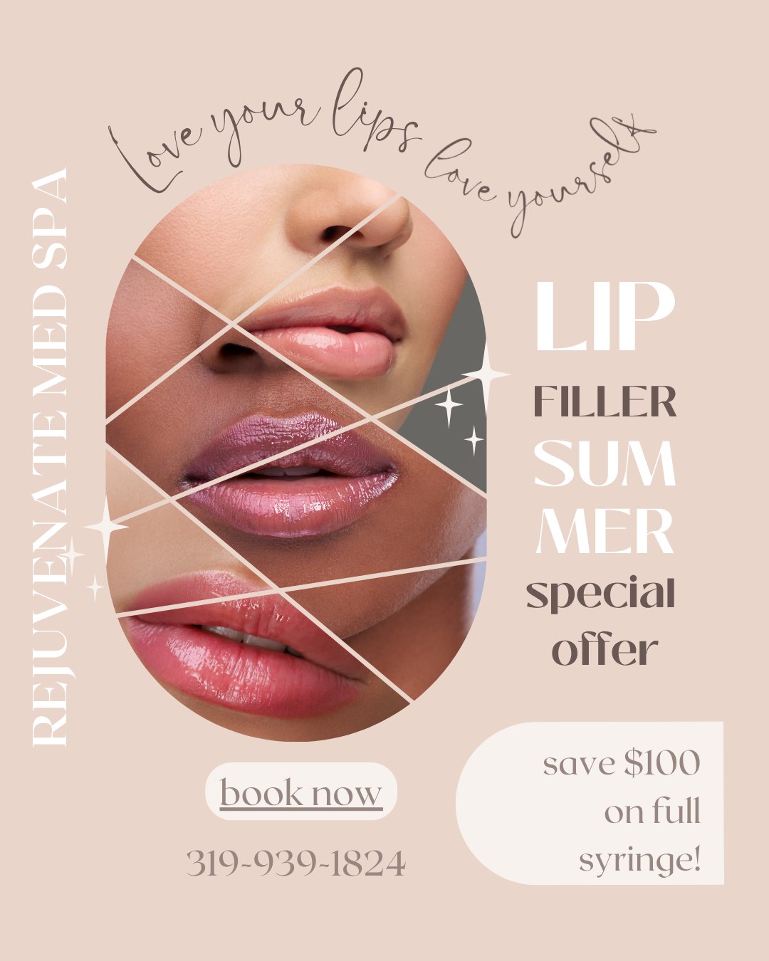 💋 June Lip Filler Special is Here!💋
Ready to add volume, enhance your natural shape, or achieve the perfect pout? Now is the perfect time!
✨ $100 OFF a Full Syringe of Lip Filler
✨ $50 OFF a Half Syringe of Lip Filler
Whether you're looking for a subtle refresh or a more noticeable enhancement, our experienced injectors will create a customized treatment plan to help you achieve beautiful, natural-looking results.
📅 Special pricing available throughout June only!
📞 Call us today to schedule your consultation and appointment before this special ends. Availability is limited, so don't wait!
📲 Call now to reserve your spot and get summer-ready lips!
💋✨319-939-1824
📍 212 E 4th St, Waterloo, IA 50703
🔗 https://dashboard.boulevard.io/booking/businesses/e42807b0-3d4c-4aba-9313-3910c14faa57/widget#/cart/menu to schedule your appointment today
💻 rejuvenatemedspaia.org
📱RepeatMD: https://rejuvenate.repeatmd.app/signin