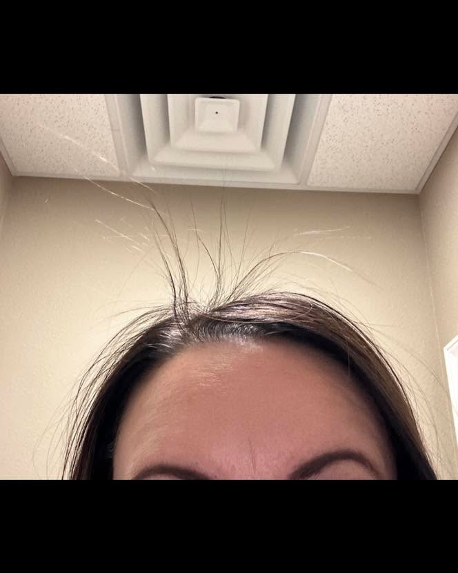 You’ve been hearing us talk about Activ for hair growth… but does it actually work?
Meet the Activ effect. 👏
No fancy lighting. No tricky angles. No editing magic.
Just a real Image Makers guest, a loyal Activ user, and a pretty impressive little spiky mohawk growing in where hair had been lost. ❤️
Hair loss can happen for so many reasons—stress, illness, medication, hormones, surgery, postpartum changes, and more. Watching this kind of regrowth is one of our favorite things.
We’re so excited for her and honored to be part of the journey.
Have questions about Activ or whether it might be a good fit for you? Send us a DM. We’d love to chat.