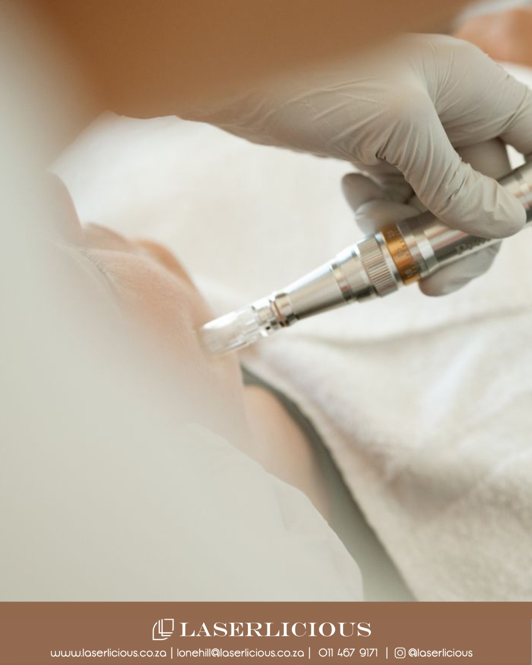 Looking for smoother, healthier-looking skin? Winter is the perfect time to invest in microneedling.
This advanced collagen-stimulating treatment helps improve the appearance of fine lines, acne scarring, pigmentation and uneven skin texture, leaving your complexion looking fresher and more refined.
With reduced sun exposure during winter, your skin has the ideal opportunity to recover and renew. Call Laserlicious on 011 467 9171 / WhatsApp 083 490 9524 / info@laserlicious.co.za to make a booking today 📞
#Laserlicious #Microneedling #CollagenBoost #WinterSkin #HealthySkin