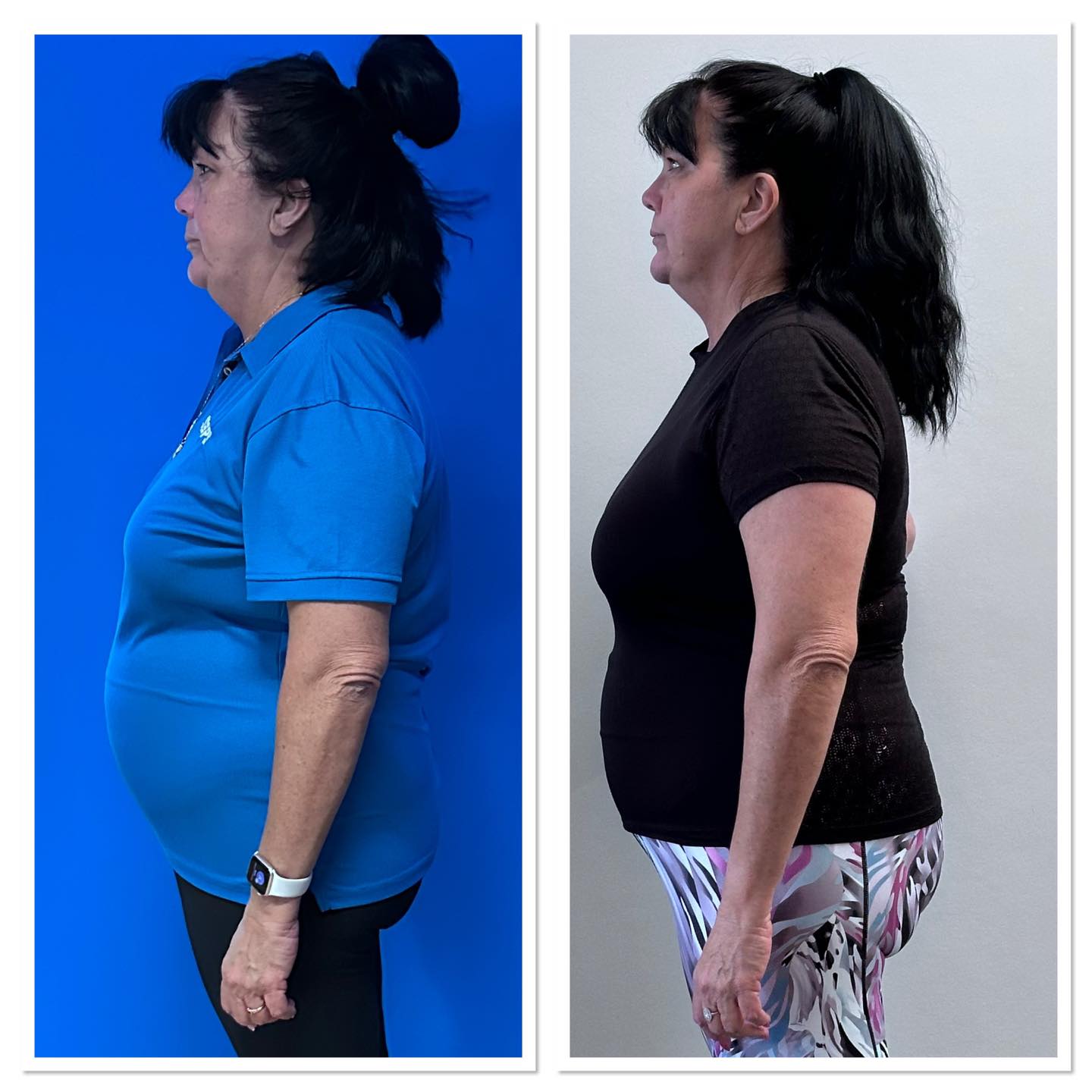 Miss Brenda’s first progress pics 🤩
4 weeks ago Brenda came to me for a nutrition plan.
In her first week she lost a couple of kgs and was so impressed with the plan that she decided to join the gym too.
Fast forward 3 weeks and Brenda has already lost 5.7kgs.
Congratulations for choosing you and keep up the great work hun, you got this 💯🥰