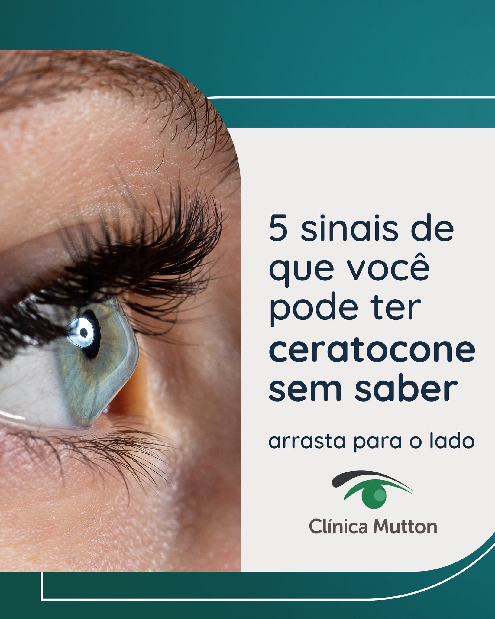 Visão que nunca resolve, grau que muda todo ano, distorção que os óculos não corrigem — esses sinais parecem simples mas podem ser ceratocone.
A doença é progressiva e atinge principalmente jovens. O diagnóstico precoce é o que mantém as melhores opções de tratamento disponíveis.
Arraste até o final, salve e mande para quem precisa ver isso. 👁️💙
📍 Agende sua avaliação pelo link na bio.
Dr. Fernando Mutton
CRM SP 803999
RQE 20279
Dr. Gabriel Mutton
CRM 264060
#ceratocone #saúdeocular #oftalmologista #córnea #oftalmologiamutton