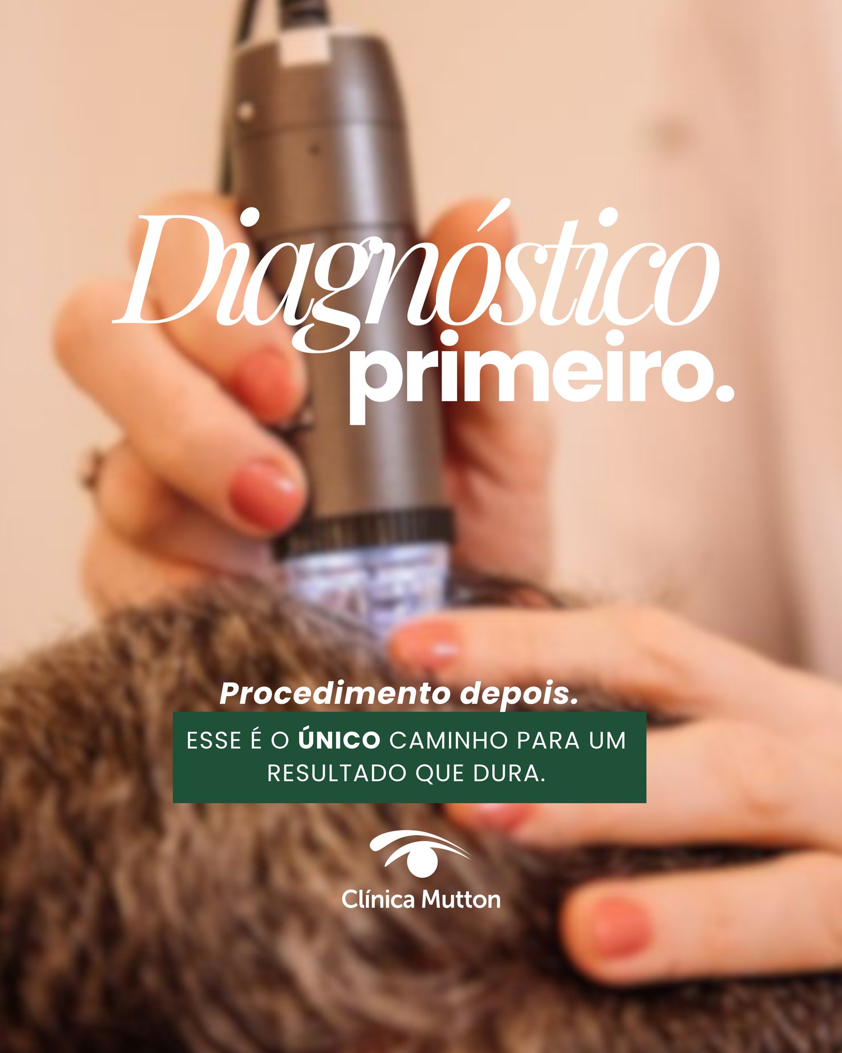 Diagnóstico primeiro, procedimento depois — essa é a filosofia por trás de cada tratamento aqui na clínica.
Antes de qualquer decisão, é preciso entender a causa da queda, o estágio em que ela está e quais opções fazem sentido para aquele caso específico. Só assim o resultado é previsível, natural e duradouro.
Quer dar esse primeiro passo? Link na bio. 🩺
Dra. Vanessa Mutton
CRM 80450 | RQE 20280
#dravanessamutton #transplantecapilar #diagnosticocapilar