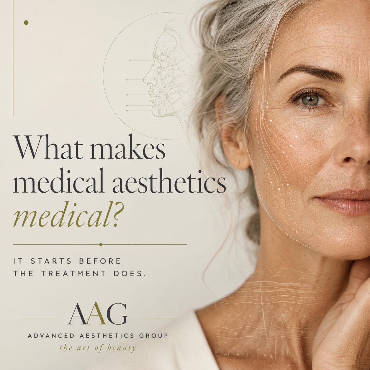 What does “medical” in medical aesthetics actually mean?
“Medical aesthetics” isn’t simply a more advanced facial or a stronger treatment.
The medical part matters because your skin doesn’t exist separately from the rest of your health.
Before recommending a treatment, we may need to consider:
• Your medications and supplements
• Previous or current skin cancers
• Autoimmune or inflammatory conditions
• Allergies and previous reactions
• Hormonal changes and menopause
• History of cold sores or abnormal scarring
• How well your skin heals
• Changes in skin thickness, elasticity and facial volume
• Previous procedures, injectables and energy-based treatments
These details can affect which treatment is appropriate, how aggressively we treat, how your skin may heal, and sometimes whether we should treat at all.
And that becomes increasingly important as we age. Skin becomes thinner and repairs itself differently, while our medical histories and medication lists often become more complex.
Sometimes good medical aesthetic care means recommending a different treatment. Sometimes it means adjusting settings or creating a more gradual plan. And occasionally, it means recognizing something that should be evaluated medically before we treat it cosmetically.
At Advanced Aesthetics Group, the goal isn’t simply to ask:
“What treatment do you want?”
It’s to ask:
“What are you hoping to improve—and what is the safest, most appropriate way to get you there?”
That’s what the medical in medical aesthetics should mean.
Healthy skin. Thoughtful treatment. Individualized care.
#MedicalAesthetics #SkinHealth #HealthyAging #AestheticDermatology #CincinnatiMedSpa #advancedaestheticsgroup