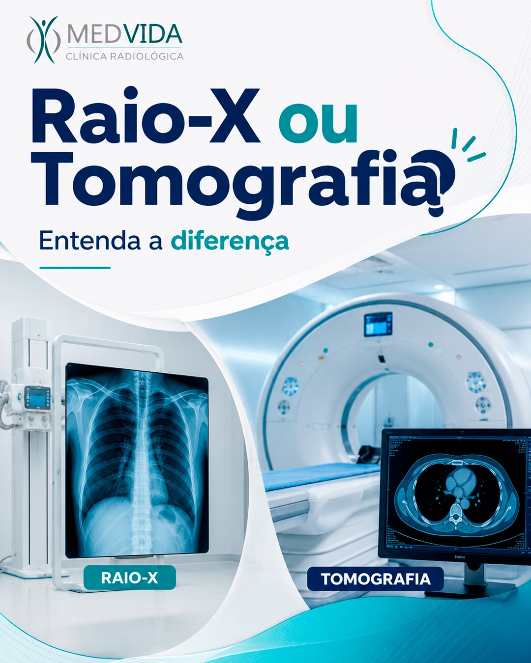 Embora ambos sejam exames de imagem, cada um tem uma finalidade específica.
✔ Raio-X: é um exame rápido, muito utilizado na avaliação inicial de diversas condições de saúde.
✔ Tomografia: oferece imagens mais detalhadas, auxiliando em diagnósticos mais precisos e na definição do tratamento.
A escolha do exame ideal deve ser feita pelo seu médico, de acordo com a necessidade clínica de cada paciente.
Na Clínica Medvida, você realiza seus exames com tecnologia, precisão e uma equipe preparada para cuidar da sua saúde.
Agende seu exame e conte com a Medvida para um atendimento de qualidade e confiança. 💙
🌐 www.clinicaradiologicamedvida.com.br
📍 Pirassununga – Av. Newton Prado, 1980 – Centro
📲 (19) 3565-3040 – WhatsApp
#Medvida #RaioX #TomografiaComputadorizada #DiagnosticoPorImagem #Radiologia #Saude #ExamesMedicos #ImagemMedica #TecnologiaEmSaude #ClinicaRadiologica