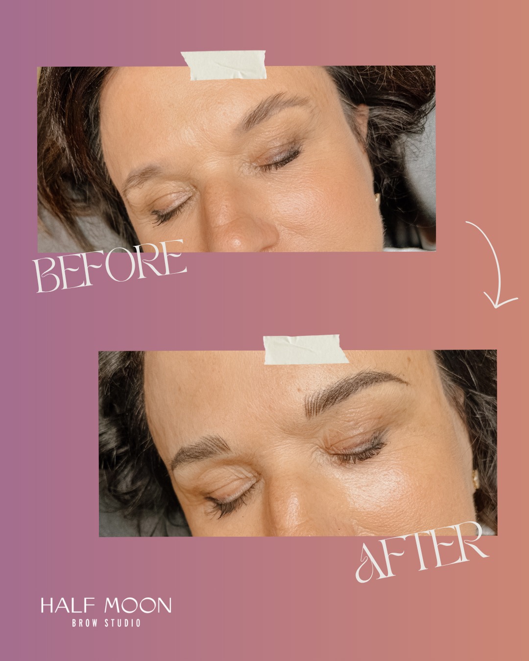 Before & after by Kellie ✨
Look at this combo brow transformation! It's the best of both worlds—soft, natural strokes up front and a little more fill through the tail, so your brows look full but still like...your brows. No more filling them in every morning 🙌
💕 Take a peek at all our services through the link in our bio and find what's calling your name ✨
#beforeandafter #combobrows #indyselfcare #IndianapolisBeauty #ThingsToDoInIndy #SelfCareIndy #BatesHendricks #IndyBrows #halfmoonbrow #IndyWomen #ShopIndyLocal #smallbusiness #fishersindiana #NaturalBeauty