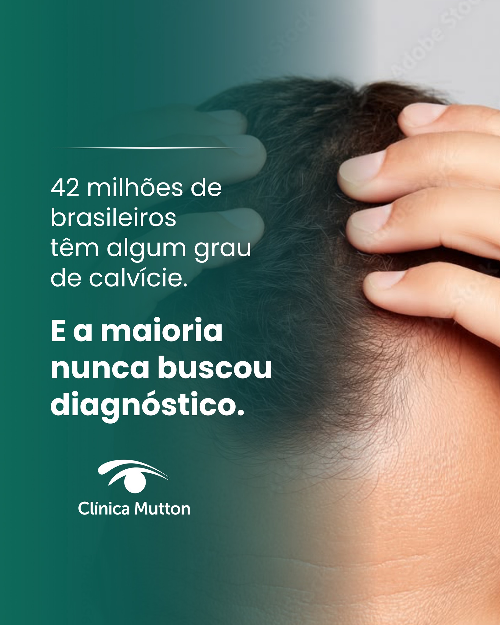 42 milhões de brasileiros convivem com algum grau de calvície — e grande parte nunca recebeu um diagnóstico de verdade.
Saber a causa é o que define o tratamento certo. Sem isso, qualquer tentativa de resolver é tentativa no escuro.
Quer entender o seu caso? Link na bio. 🔬
Dra. Vanessa Mutton
CRM 80450 | RQE 20280
#dravanessamutton #calvicie #quedadecabelo