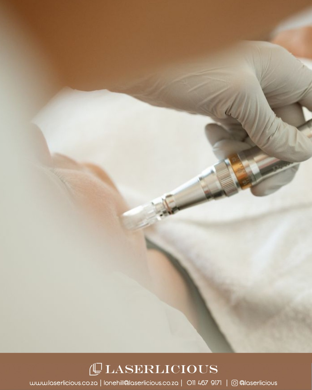 Great skin isn't created overnight.
Microneedling stimulates your skin's natural collagen production to improve texture, soften acne scars and reduce the appearance of fine lines.
With spring around the corner, now is the perfect time to invest in healthier, stronger skin.
www.laserlicious.co.za 📞 Call Laserlicious on 011 467 9171 / WhatsApp 083 490 9524 / info@laserlicious.co.za to make a booking today.
#Laserlicious #Microneedling #SkinTexture #AcneScarring #SkinTreatments