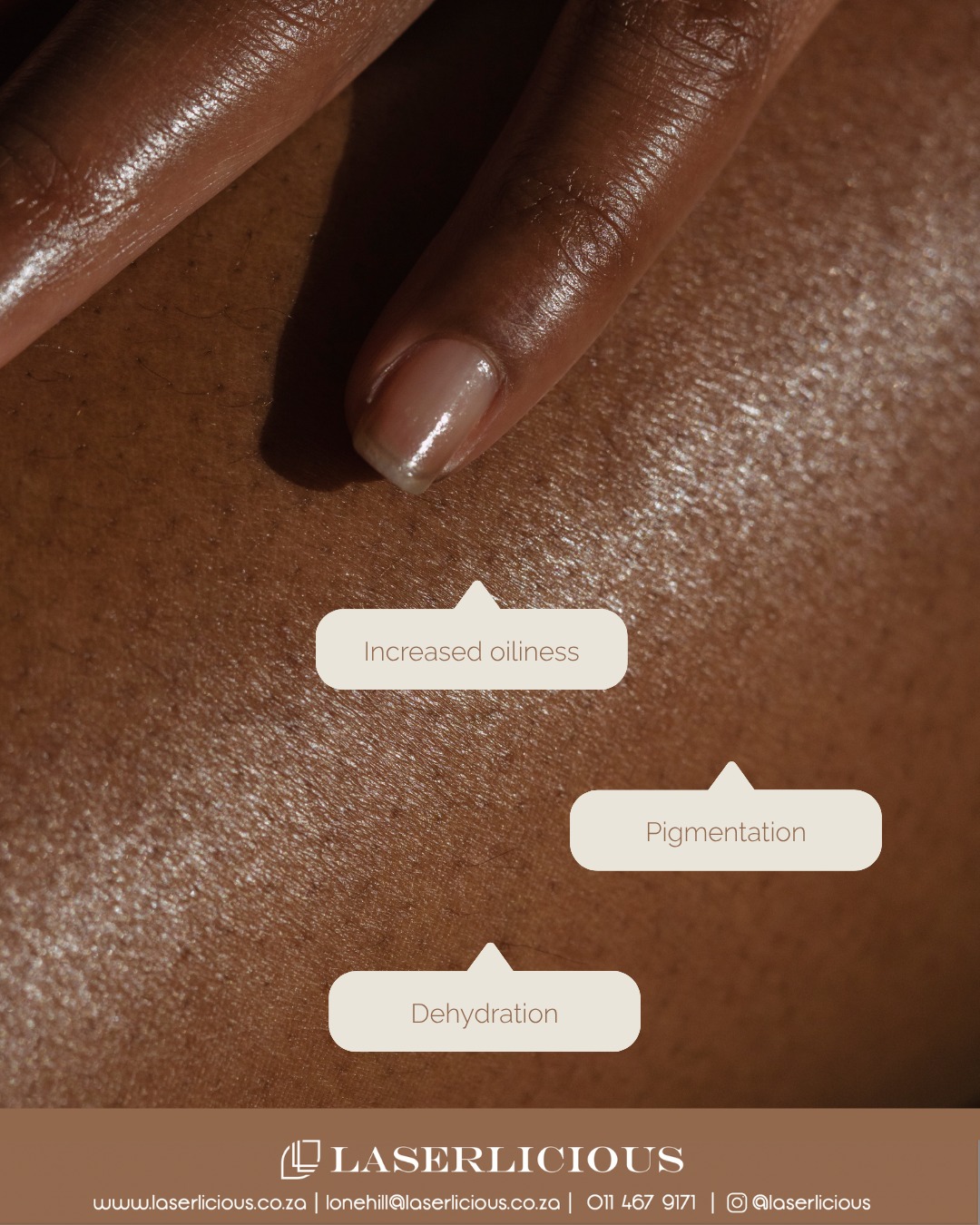 Good skin starts with knowing what your skin actually needs.
At Laserlicious, our aesthetic treatments are tailored to you - whether you’re looking to improve uneven texture, pigmentation, breakouts, dehydration or the visible signs of ageing. From professional chemical peels and microneedling to targeted facials and advanced skincare, we’ll help you choose treatments that work with your skin and your individual goals.
No one-size-fits-all approach. Just professional care, personalised to your skin. Find out more about our cosmetic dermatology treatments by clicking the link in our bio 🔗
#Laserlicious #AestheticTreatments #SkinTreatments #ProfessionalSkincare #SkinHealth #HealthySkin #Microneedling #ChemicalPeels #AestheticClinic #JohannesburgAesthetics
