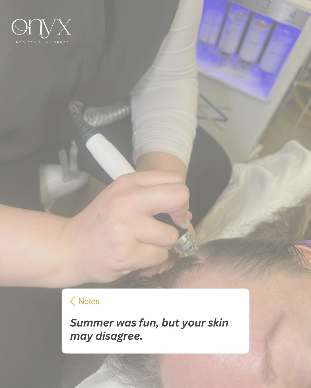 Summer was fun, but your skin may be ready for a reset...
Sun exposure, heat, sweat, travel, chlorine, and inconsistent routines can leave skin looking dull, dry, congested, uneven, or textured.
Whether your goal is smoother texture, a brighter-looking complexion, hydration, or overall skin renewal, our team can help you decide where to start!
Book your consultation with Onyx Med Spa & IV Lounge and let’s repair the damage summer left behind: https://www.onyxmedspanea.com/
#onyxmedspanea #onyxmedspaar #onyxmedspajbr #jonesboro #jonesboroskincare #jonesborospa #jonesboromedspa #jonesboromedicalspa #jonesboroinjector #smoothskin #arkansas #arkansasspa #arkansasmedspa #preventive #arkansamedicalspa #arkansasinjector #wellnessjourney