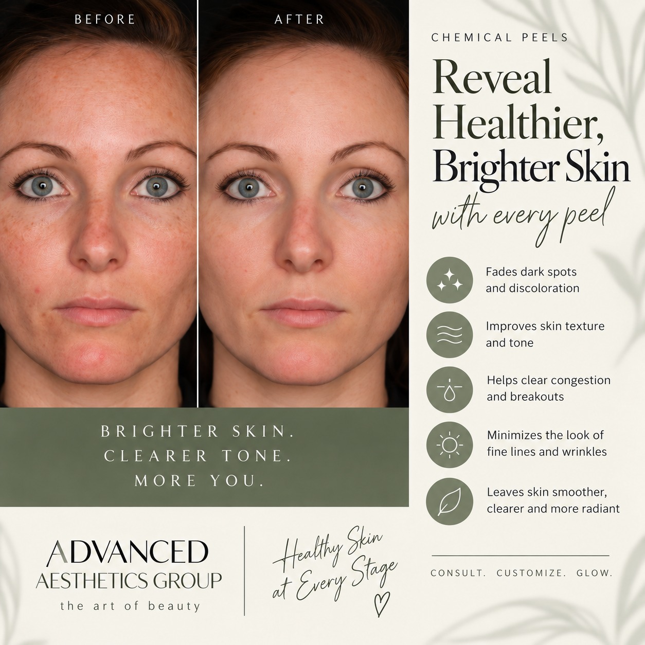 Peel season is officially here. ✨
Chemical peels are one of our favorite ways to refresh the skin when it starts looking dull, uneven or congested.
Depending on your skin and the peel selected, benefits can include:
Brighter, more even-looking tone
Smoother texture
Softening the appearance of discoloration
Refining the look of pores
Improving acne-prone or congested skin
Softening the look of fine lines
Supporting healthy skin turnover
Every peel is selected based on your skin, your tolerance and your goals. Some patients benefit from a single refresh, while others see their best results with a customized series.
Fall and winter are especially lovely times to start because we generally have less intense sun exposure to work around.
Consult. Customize. Glow.
Advanced Aesthetics Group
advancedaestheticscinci.com
#ChemicalPeel #PeelSeason #SkinRejuvenation #Hyperpigmentation #AcneTreatment #GlowingSkin #CincinnatiAesthetics #CincinnatiMedSpa #AdvancedAestheticsGroup #TheArtOfBeauty