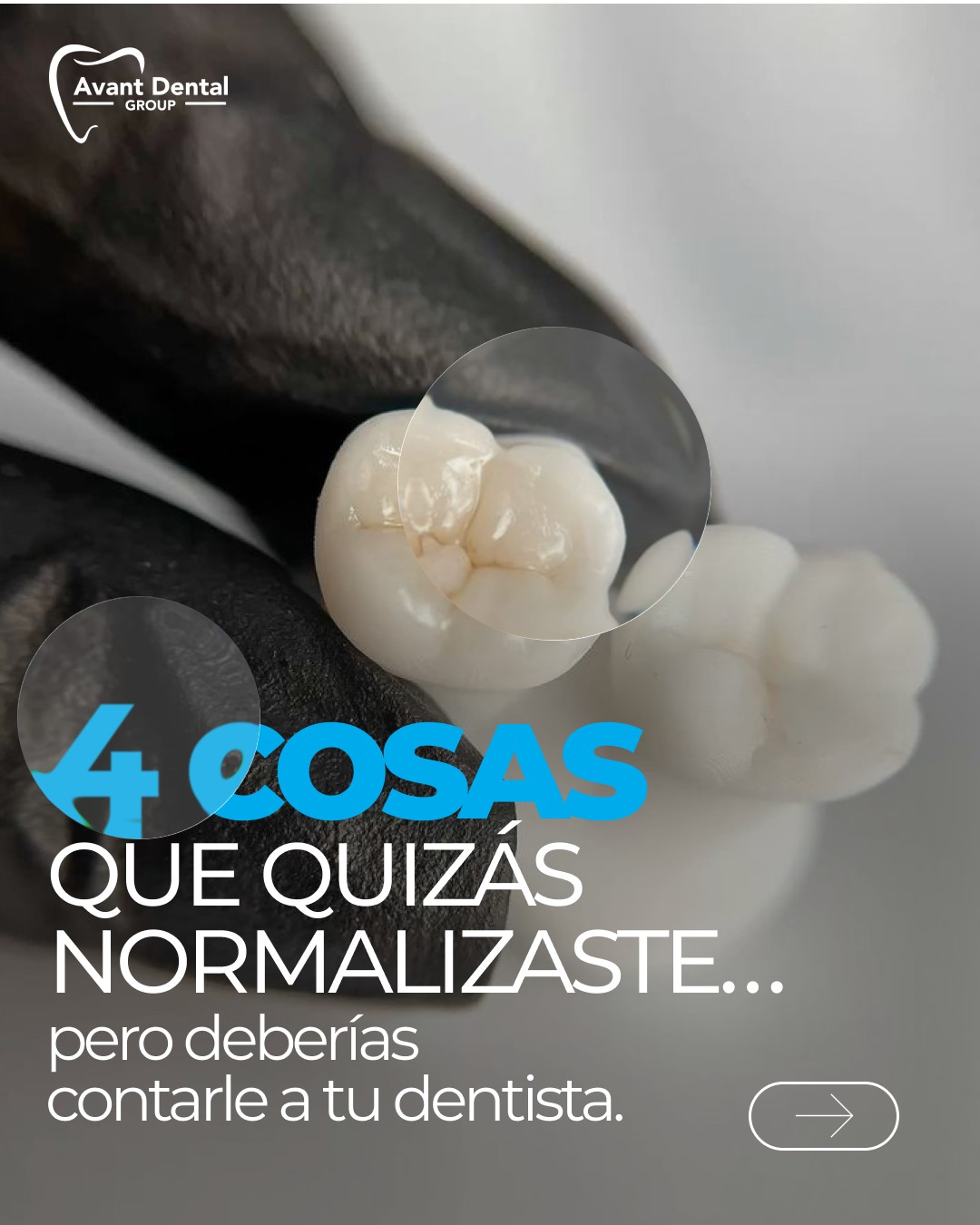 Sangrado, sensibilidad, molestias al masticar… 😬 Que lleves tiempo sintiéndolo no significa que debas seguir ignorándolo.
Tu sonrisa también habla. Escúchala. 🦷
#OralHealth #DentalTips #KissimmeeDentist #HealthyTeeth