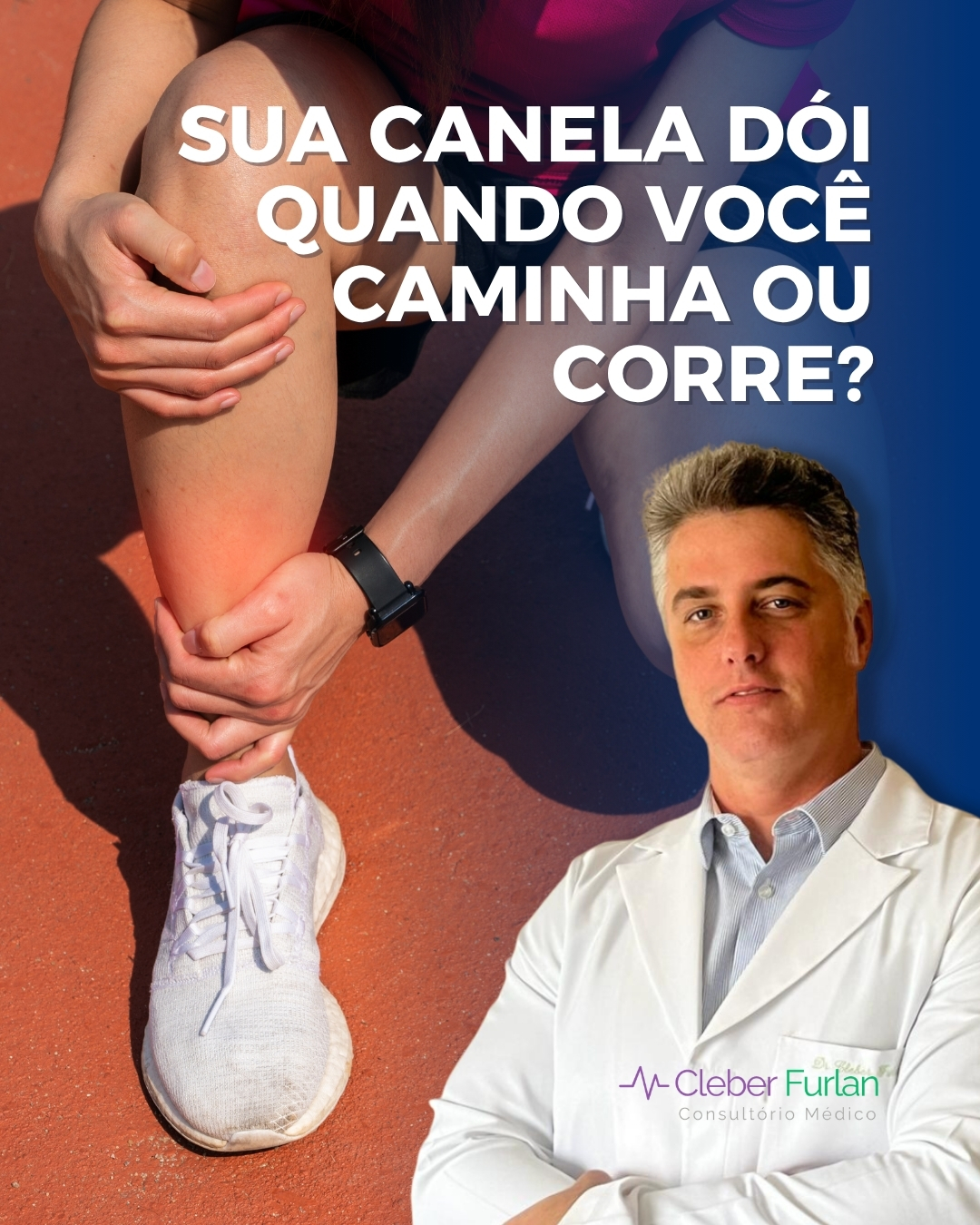 Dor na canela é daquelas que parecem simples, mas levantam uma dúvida curiosa:
afinal, o que está doendo ali? O músculo? O osso?
Depende.
Uma das causas mais conhecidas é o que popularmente chamamos de “canelite”.
Nesse quadro, o estresse repetitivo provocado pelo impacto pode gerar dor ao longo da tíbia — o osso da canela — e dos tecidos que ficam ao redor dela.
É comum aparecer depois de alguma mudança na rotina:
você começou a correr, aumentou a distância, passou a caminhar mais, elevou a intensidade do treino ou voltou à atividade depois de um período parado.
Mas nem toda dor nessa região é “canelite”.
O jeito como a dor aparece dá pistas importantes.
Uma dor mais espalhada ao longo da parte interna da canela e relacionada ao exercício pode estar associada à sobrecarga repetitiva.
Já uma dor muito localizada, em um ponto específico do osso, que vai piorando, persiste mesmo depois de interromper a atividade ou começa a incomodar
também em repouso merece uma investigação mais cuidadosa, porque pode existir uma lesão por estresse no osso.
Existem ainda outras causas de dor na região, inclusive musculares e, menos frequentemente, condições relacionadas ao aumento da pressão dentro dos compartimentos musculares da perna.
Por isso, simplesmente tentar “correr até passar” nem sempre é uma boa ideia.
Quando a dor aparece, vale primeiro observar se houve alguma mudança recente no volume ou na intensidade da atividade e reduzir temporariamente aquilo que está provocando o sintoma.
Depois, o retorno deve ser gradual.
E se a dor persistir, piorar, estiver muito concentrada em um único ponto, houver inchaço ou começar a aparecer mesmo fora do exercício, procure avaliação.
A canela pode estar reclamando do esforço. Mas entender exatamente o que está reclamando é o que define como cuidar.
👇 Você já teve aquela dor na canela que aparece justamente quando começa a aumentar as caminhadas ou corridas?
Dr Cleber Furlan