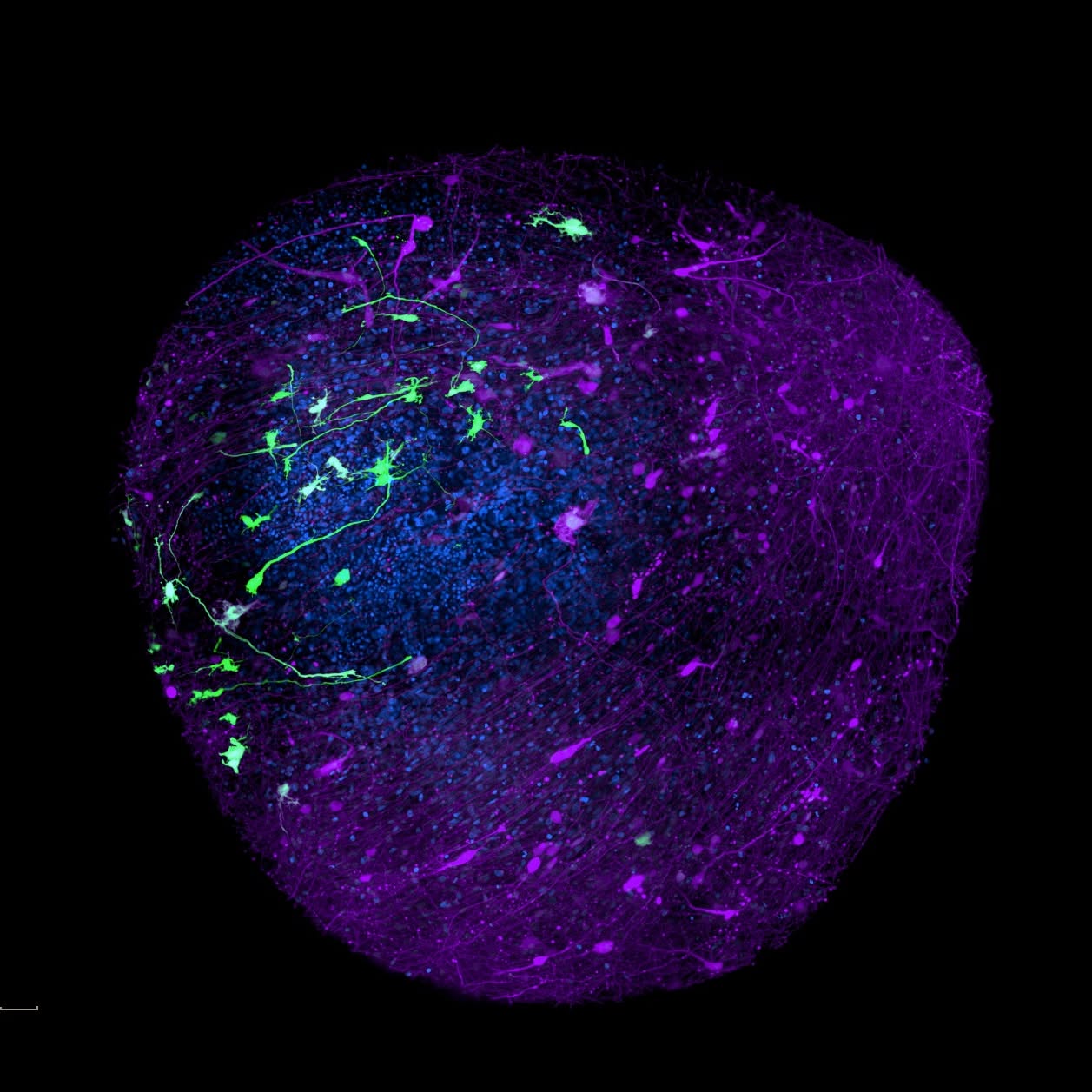 It’s been a while since we shared a stained midbrain organoid! Here, neurons (AAV-synapsin) are purple, astrocytes (AAV-GFAP) are green, and nuclei (DAPI) are cyan, just like spooky season in October 🧙♀️🎃. #organoid #iPSC #neuroscience
📸Credits: Maria Baeza Tallero, Martin Berryer and Andrea Krahn