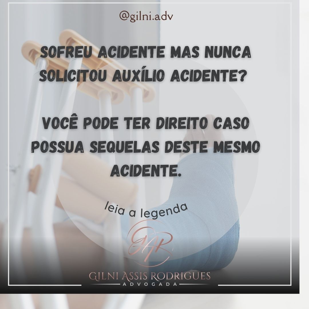 O auxílio acidente é um benefício indenizatório do INSS aos que sofrem acidente de qualquer natureza.
Ele é diferente do Auxílio Doença, pois o auxílio acidente é pago mesmo após a vítima voltar ao trabalho, ou seja, permite que você receba seu sálario e o benefício cumulativamente.
Outra diferença é de que não é necessário carência para ter direito. Quer saber mais informaçoes ?
Link do whatsapp na bio para esclarecer suas dúvidas.