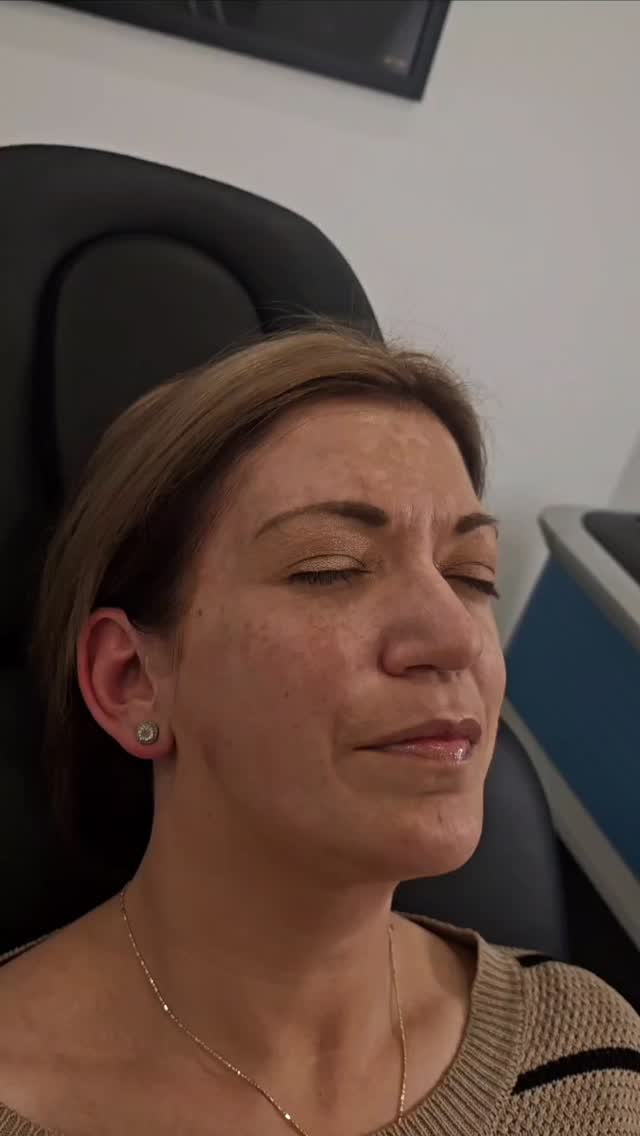 PicoSure laser: the gentle yet powerful solution to melasma and uneven skin tone.
#TattooRemoval
#PermanentMakeupRemoval
#PMURemoval
#PicoSureTattooRemoval
#LaserTattooRemoval
#WindsorTattooRemoval
#DetroitTattooRemoval
#TattooRemovalWindsor
#TattooRemovalDetroit
#RemoveTattoo
#TattooRemovalSpecialist
#ClearSkinJourney
#EraseTheInk
#TattooRemovalExperts
#PMUTattooRemoval
#GoodbyeInk
#LaserAway
#PicoLaserRemoval
#CosmeticTattooRemoval
#WindsorLaserClinic
#DetroitBeauty
#LaserAesthetics
#TattooFading
#TattooFree
#Detriot
#Windsor
#Montellbeauty
#Melasma
#Melasmaremoval