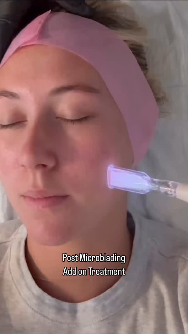 Cold Fusion Therapy Post-Microblading at Beverly Hills Microblading
Enhance your microblading experience with our state-of-the-art Cold Fusion Therapy, designed to offer unparalleled post-treatment benefits using cold atmospheric plasma. This non-invasive treatment accelerates healing, reduces inflammation, and provides antimicrobial protection, ensuring your brows look their best.
Benefits of Cold Atmospheric Plasma:
- Accelerated Healing
- Reduced Inflammation
- Antimicrobial Properties
- Enhanced Skin Rejuvenation
Expect:
✅ No Bleeding
✅ No Bruising
✅ No Edema
✅ No Inflammation
✅ No Oozing
✅ No Excoriation
✅ No Scabbing
✅ No Removal of Skin Below the Epidermis
✅ No Heating or Burning of the Skin
Cold Fusion Therapy surpasses traditional red light therapy by offering deeper, more effective skin rejuvenation without any discomfort. While both treatments promote healing, cold fusion provides superior results through its advanced plasma technology.
Add this remarkable treatment to your booking as a post-microblading add-on and experience the difference. To book, text 310-853-0744.
#Beverlyhillsmicroblading #coldplasma #redlighttherapy #ericakovitz