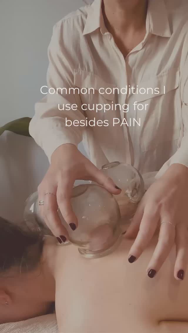 If you know, you know how delightful cupping is, and how good it is for you 💕
Cupping isn’t just for easing pain, though it does also do that.
As a practitioner I love to see a very obvious shift in the level of calm in the patient when the cups come off.
Cupping is a technique that works wonders for a variety of issues besides pain—here’s how:
👉 Stress & Anxiety: Cupping helps to calm the nervous system, promote circulation, and relax tense muscles, making it an effective tool to ease stress and restore balance in both the mind & body.
👉 Perimenopause: Struggling with hot flushes or mood swings? Cupping supports hormone regulation by moving the body into a parasympathetic state, improving sleep, and alleviates tension, offering much needed relief during this transition.
👉 Colds & Flus: Feeling run down? Cupping helps boost immunity, clear congestion, and relieves chest tightness, giving your body a head start in recovery. This is due to working on the Bladder & DU meridians which run down the back, with the bladder meridian being the most external channel in the body, allowing the cups to expel the cold & flus from the body before they settle in and progress into something more serious or prolonged, or to break up established phlegm congestion.
Cupping is combined with acupuncture in my clinic, and I find that the body responds best to needles when it is in a state of calmness.
Cupping & Acupuncture available in Melbourne – in Middle Park.
If you are interested in cupping and acupuncture DM me any questions, or links for booking in my bio.
Glow Acupuncture & Chinese Medicine 106 Canterbury Rd, Middle Park VIC 3206
.
.
.
.
.
.
#cuppingtherapy #cupping #heartmiddlepark #thisisKingston #middlepark #albertpark #southmelbourne #portmelbourne #cheltenham #chinesemedicine #acupuncture #nervoussystemhealing #perimenopause #menopause #stress #anxiety #moodswings #hormoneregulation