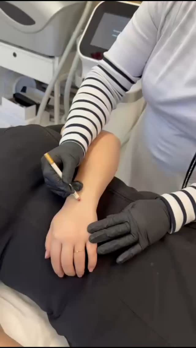 Boek nu je behandeling en ga een haarvrije zomer in. Laserontharing met de Diode Ice Laser is een revolutionaire methode voor pijnloze en effectieve haarverwijdering. Dankzij de geavanceerde Ice-technologie wordt de huid gekoeld tijdens de behandeling, waardoor het comfortabel en vrijwel gevoelloos aanvoelt.
De diode-laser dringt diep door in de haarzakjes, vernietigt deze op een veilige manier en voorkomt zo nieuwe haargroei. Geschikt voor vrijwel alle huidtypes en lichaamsdelen, biedt deze methode langdurige resultaten zonder irritatie. Nog twee dagen en dan maak ik de winaar bekend maak kans op een heerlijke behandeling💛🌞
#browstylistmali #diodeicelaser @beautyboxandelly#laserontharing #trots #allaroundpmuartist #gezichtbehandeling #brows
#phinderland #masterworks #nederland🇳🇱