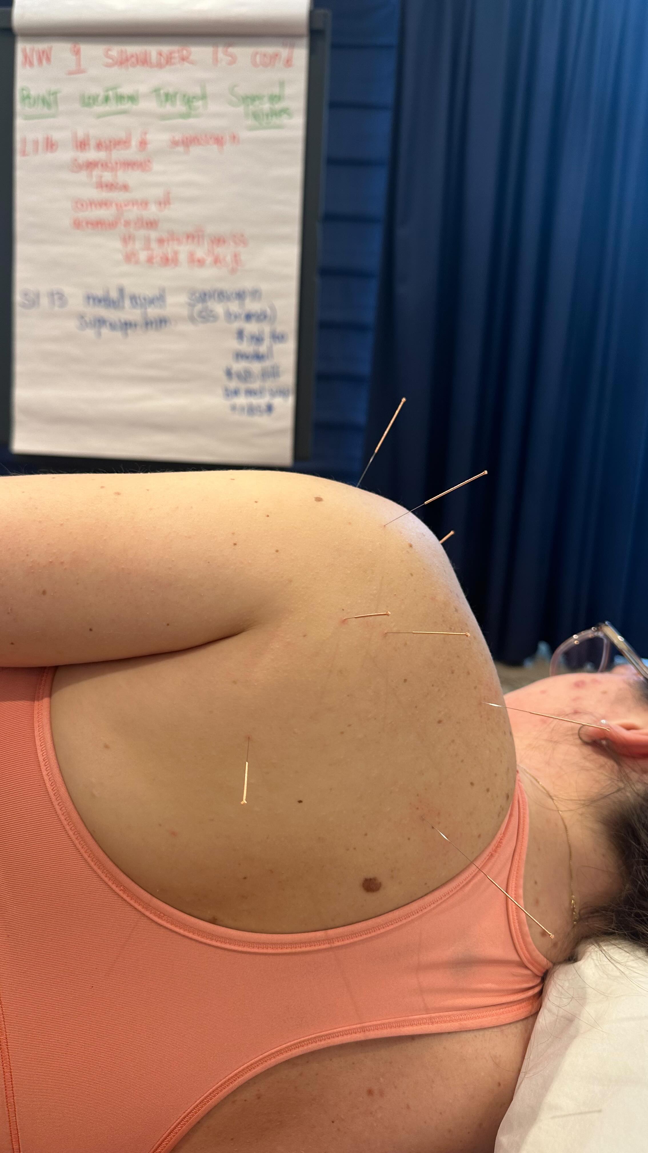 Excited to announce that I have completed McMaster University’s Contemporary Neurofunctional Acupuncture course! Over the past three months, I’ve delved into the world of neurofunctional acupuncture, mastering techniques to effectively treat neuromusculoskeletal conditions. I am thrilled to add this powerful tool to my practice, empowering my patients to feel and move their best! 💪🏼💫 #acupuncture #neurofunctionalacupuncture #mcmasteruniversity #hamiltonchiropractor