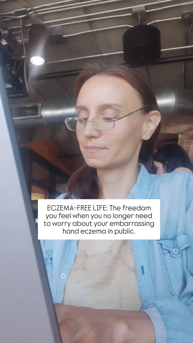 12 years ago, I first experienced signs of chronic eczema on my hands, but thankfully, I've been ECZEMA-FREE for 8 years now. How did I do it?
🌿 I ditched steroid creams
💚 I lowered my stress levels
🌿 I embraced the hydrating and anti-inflammatory alkaline diet
💚 I lowered my protein intake
These are just a few of the many changes I made to see complete healing in 90 days.
If you're tired of managing symptoms and want to reverse your eczema for good NATURALLY, I offer a FREE mini course that will completely shift everything you know about eczema and help you heal it from the root cause!
✅ If you want it, DM me the word "ECZEMA COURSE," and I will send you the link. ✨
.
.
.
.
.
.
#eczema #eczemarelief #eczemaflareup #eczemahealing #handeczema