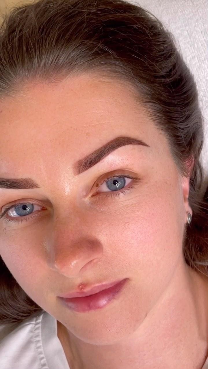 Ombré brows 👌🏼👌🏼
Say goodbye to your brow struggles and hello to ombré perfection! 🙌💖 Unleash your inner goddess with flawlessly shaded brows. Don’t wait, book your appointment today!
#brows #BrowMakeover #ConfidenceBoost #brows #eyebrowtattoo #browtattoo #inked #cosmetictattoo #ombre #powderbrows #eyebrows #beauty #eyebrowshaping #ombrebrows #eyebrowsonpoint #beautiful #makeover #browgoals #transformation #eyebrowsonfleek #browsonfleek #browgame #nomakeup #nofilter #predraw #browspecialist #browstylist