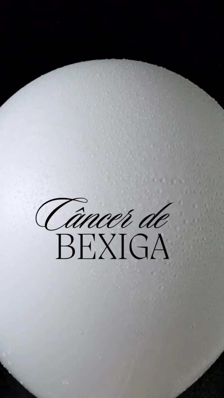 Uma análise comparou pacientes com câncer de bexiga que pararam de fumar antes do diagnóstico de câncer.
Eles descobriram que entre os pacientes com câncer de bexiga, 22,4% eram fumantes ativos, 26,8% nunca fumaram e 50,8% eram ex-fumantes.
Os pesquisadores notaram um intervalo de médio de 20 anos entre parar de fumar e o diagnóstico de câncer de bexiga.
Isso significa que tanto os fumantes ativos quanto os ex-fumantes apresentam um risco de câncer de bexiga, que é até quatro vezes maior em comparação aos não fumantes.
No entanto, apesar do risco diminuir gradualmente após a cessação do tabagismo, leva até 20 anos para que a redução do risco retorne aos níveis de uma pessoa que nunca fumou.
Por esse motivo que a maior parte dos diagnósticos sao feitos em ex- tabagistas.
Parar de fumar é uma medida crucial para diminuir o risco de desenvolver câncer de bexiga.