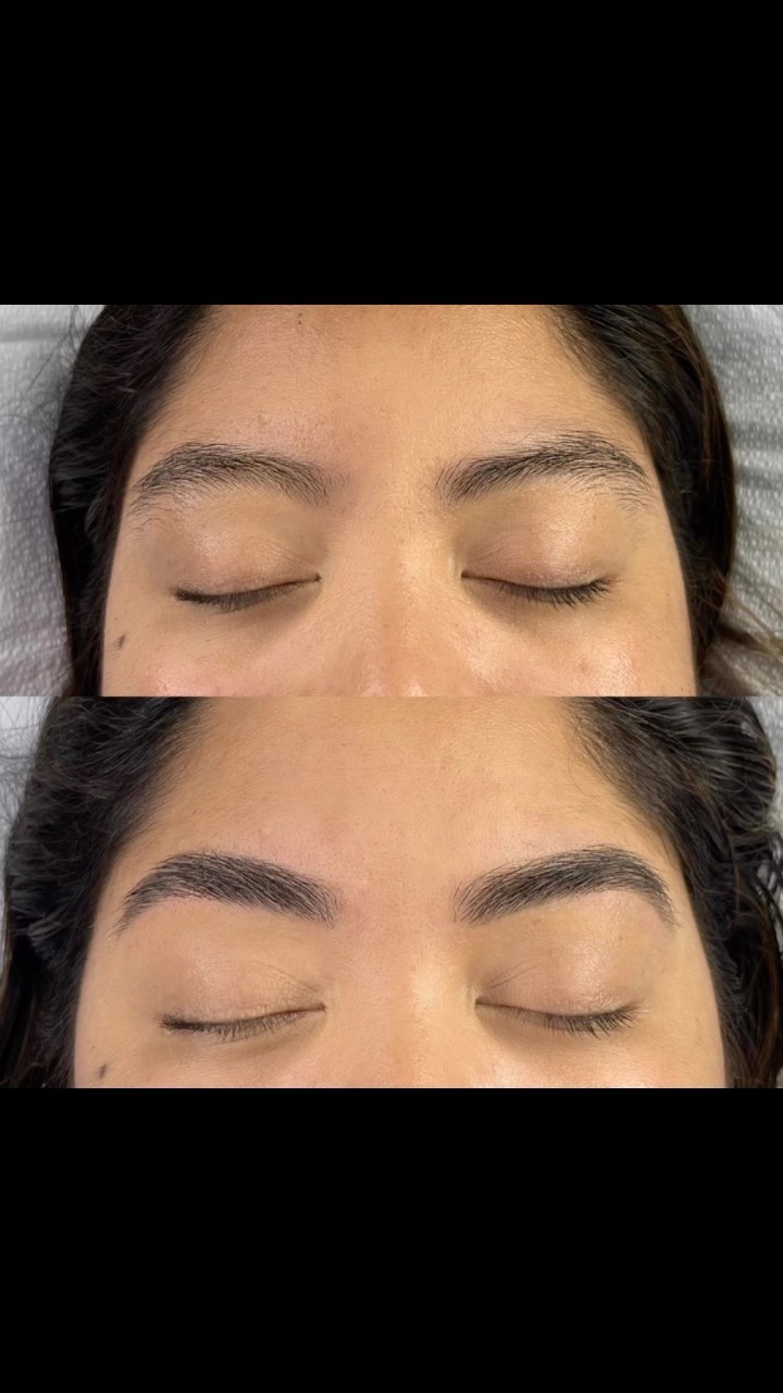 𝐁𝐫𝐨𝐰 𝐒𝐡𝐚𝐩𝐢𝐧𝐠 + 𝐁𝐫𝐨𝐰 𝐓𝐢𝐧𝐭
… when a client says “I already have dark hair so I don’t know if I’ll benefit from the tint”.
We let the 𝐫𝐞𝐬𝐮𝐥𝐭𝐬 speak for themselves 😉
This is a terrific first service for anyone who’s been thinking about getting their brows tattooed. We recommend clients with no previous brow experience to come in for a “Brow Shaping + Brow Tint” (can last up to 6 weeks) before booking a more permanent brow service with us. Please note that you have to TEXT us to book a cosmetic brow tattoo session, you will not be able to book this online.
・
・
・
・
・
・
・
For Lash, Brow, Skin or Cosmetic Tattoo bookings please visit ➡️ www.artoflash.com (or click the link in our bio) to schedule.