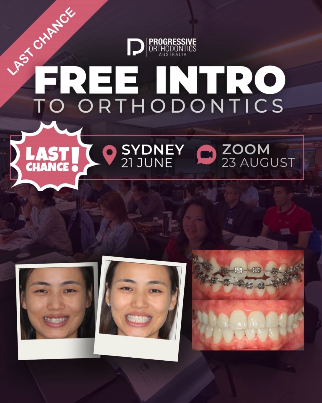 Last chance to experience our Free Intro to #Orthodontics class in Sydney! See our brand-new curriculum that includes brackets, aligners, and hybrid treatment. Earn 8 free CPDs and learn about the benefits that ortho can bring to your practice.
Last chance to sign up! Contact Zita at:
✉️ Zita@POSOrtho.net
☎️ +61 402 314 528
.
#OrthoEducation #DentalEducation