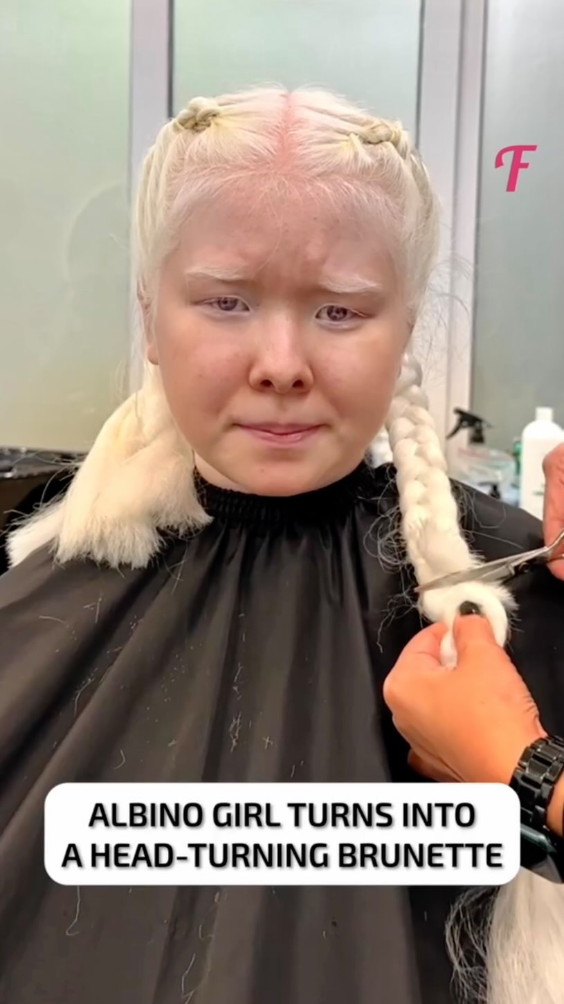 What are your thoughts guys!?!?
Video cover reads: Albino Girl Turns Into a Head-Turning Brunette —
I understand the desire for a makeover…but we’ve gotta be careful with the messaging we’re sending out. How do you all interpret this “makeover”?
.
.
.
.
.
.
.
.
.
#makeover #albanism #beforevsafter #visibledifference #skindifferent #albino #beauty #makeup #whatisbeauty